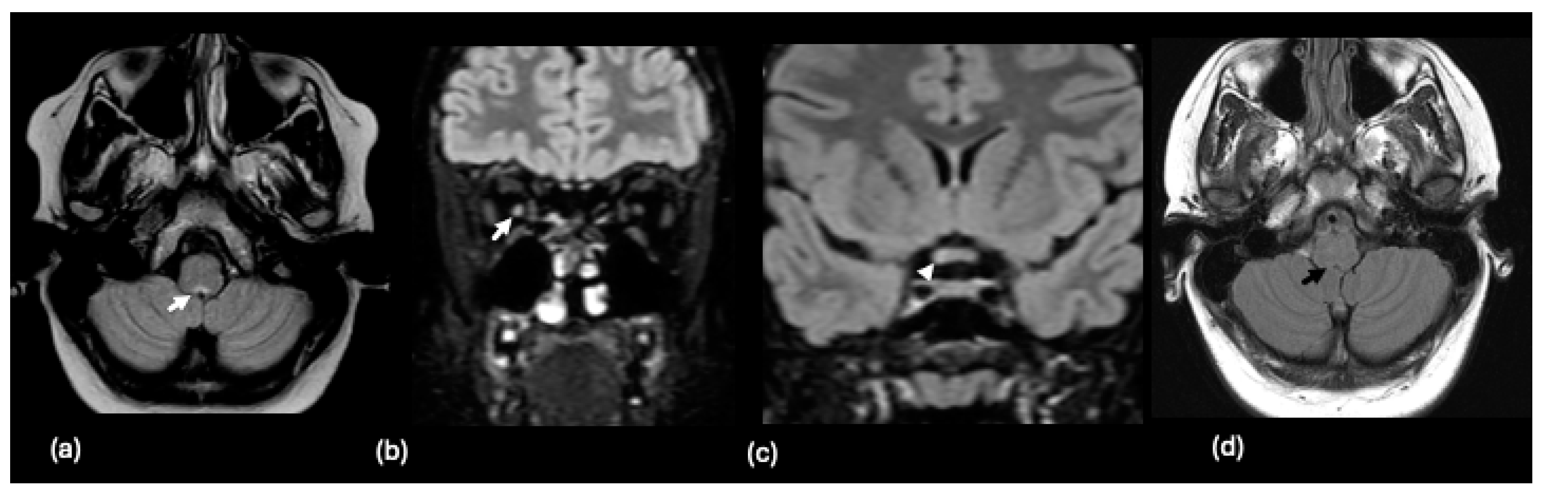 Tomography 10 00149 g007 Tomography 10 00149 g007