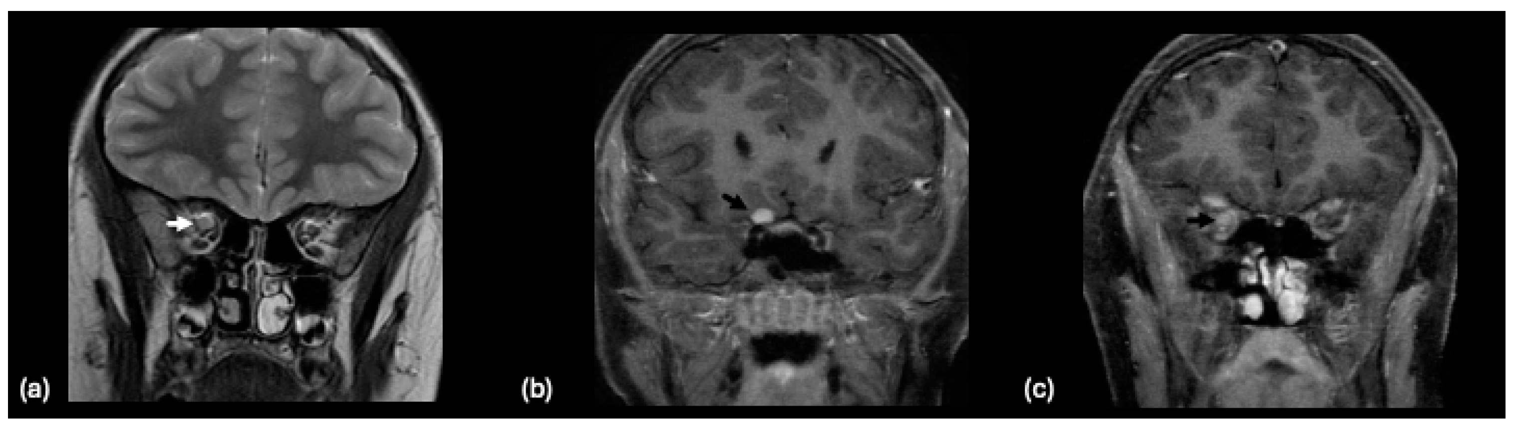 Tomography 10 00149 g008a Tomography 10 00149 g008a