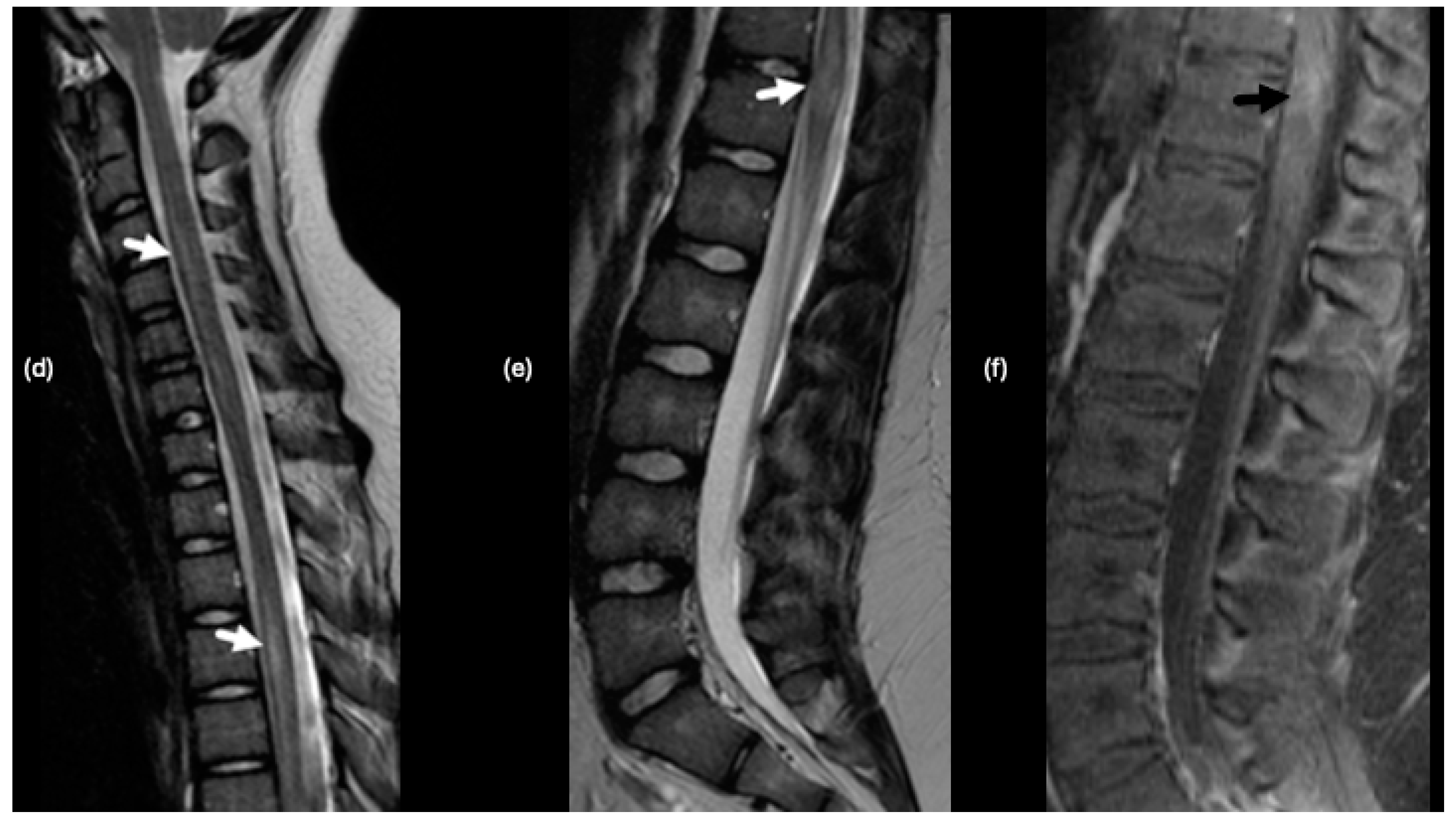 Tomography 10 00149 g008b Tomography 10 00149 g008b