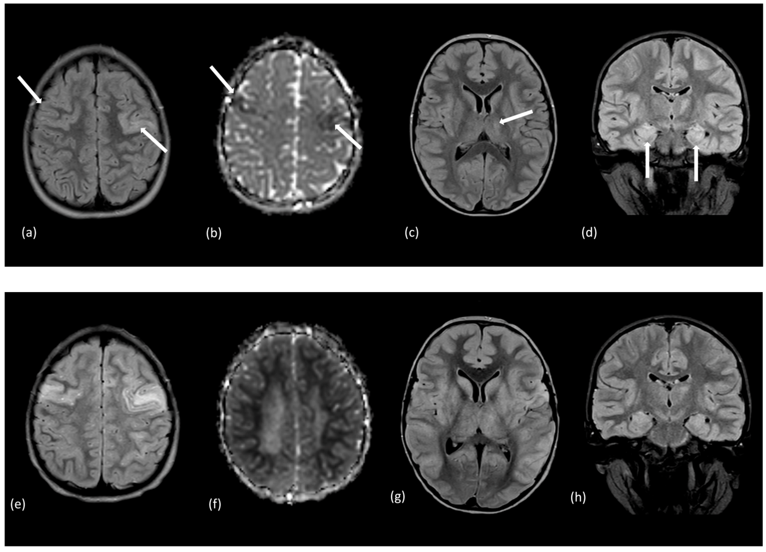 Tomography 10 00149 g010a Tomography 10 00149 g010a
