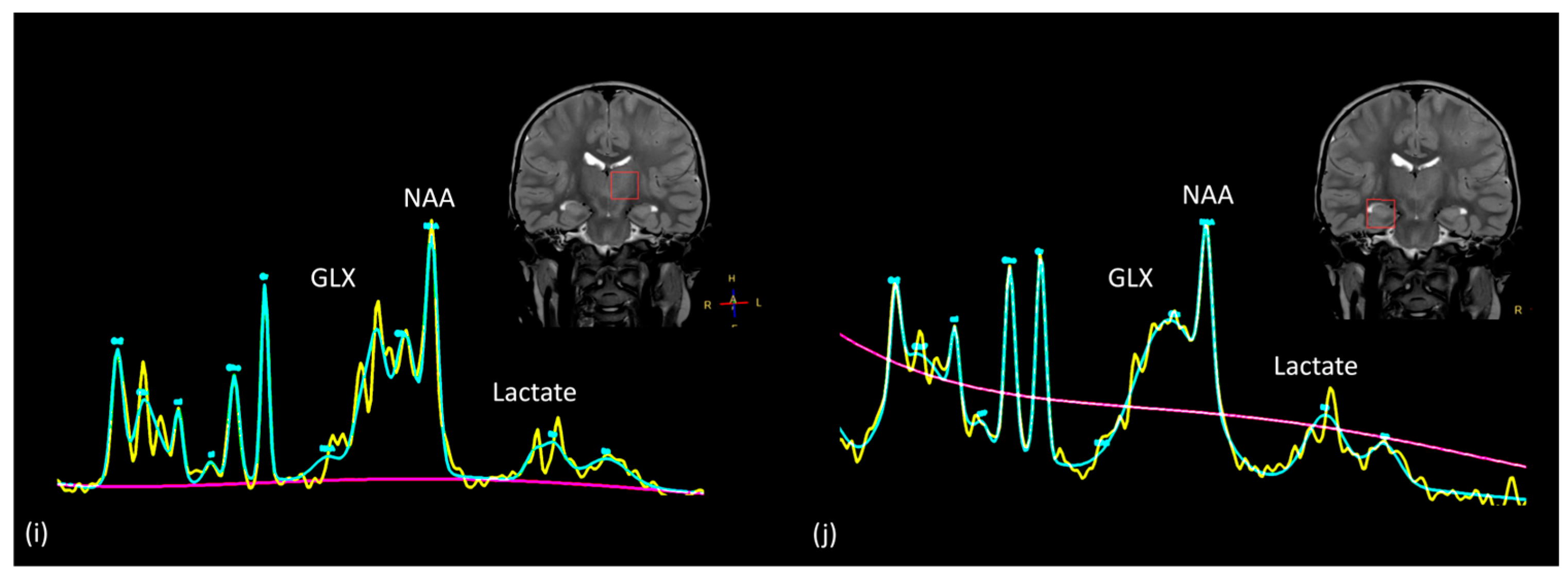 Tomography 10 00149 g010b Tomography 10 00149 g010b