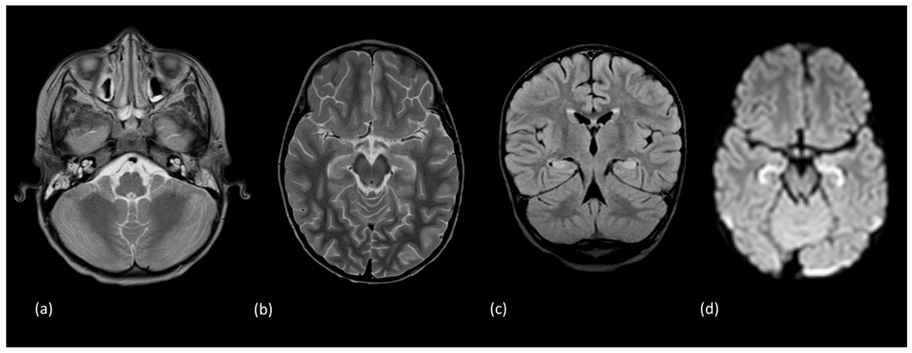 Tomography 10 00149 g011a Tomography 10 00149 g011a