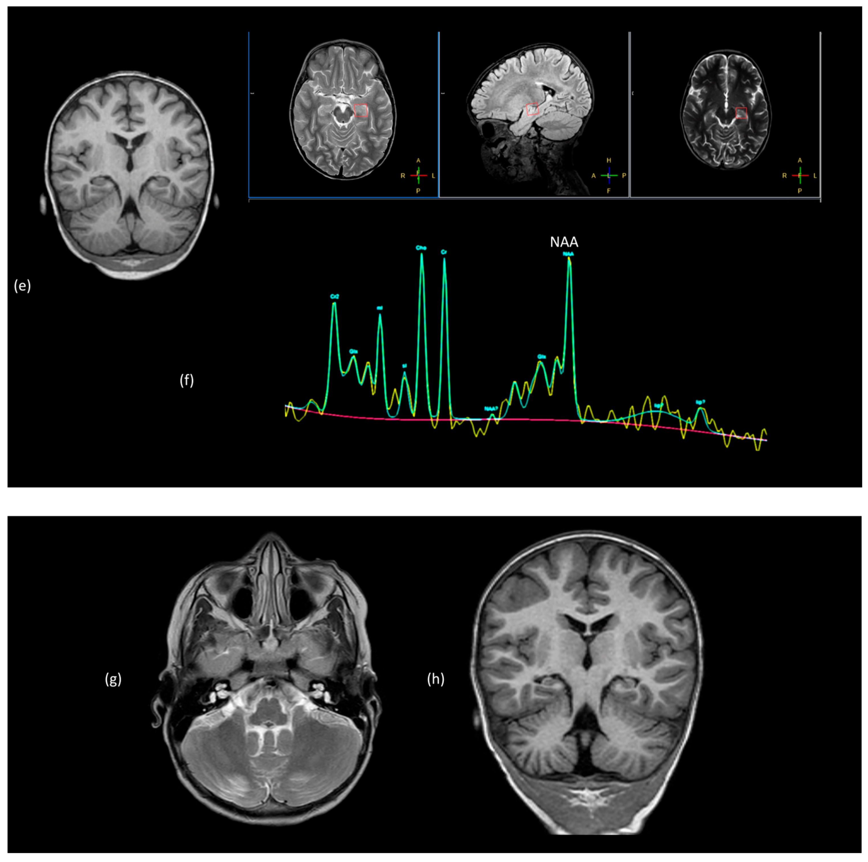 Tomography 10 00149 g011b Tomography 10 00149 g011b