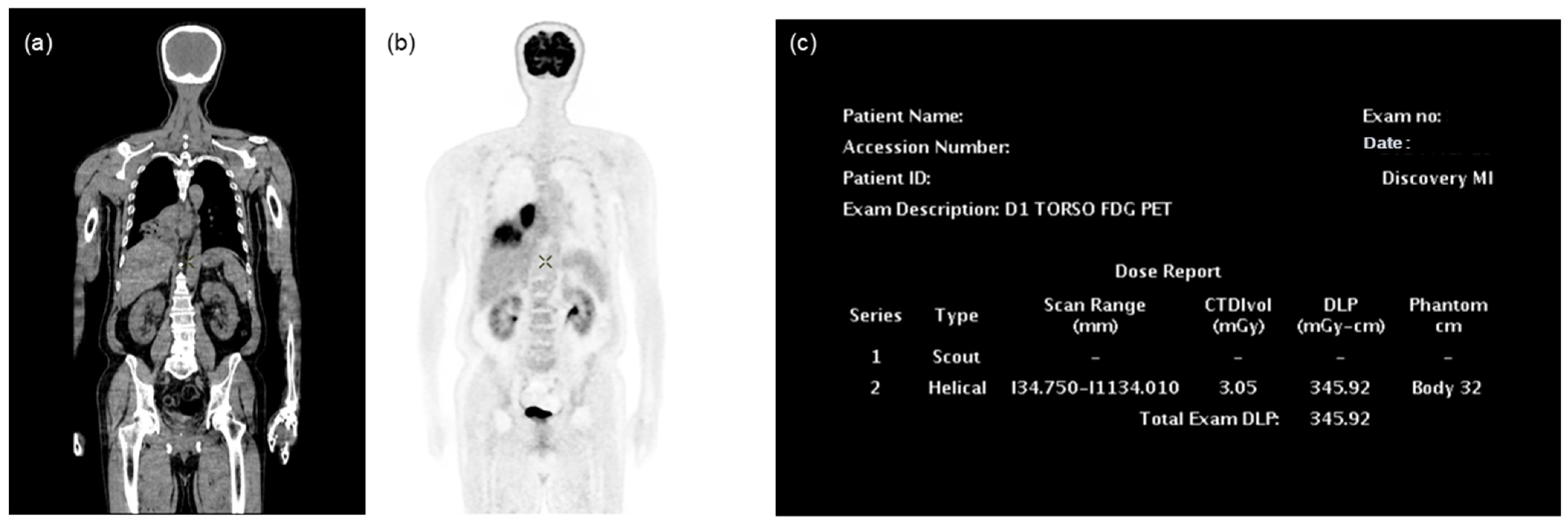Tomography 10 00151 g001