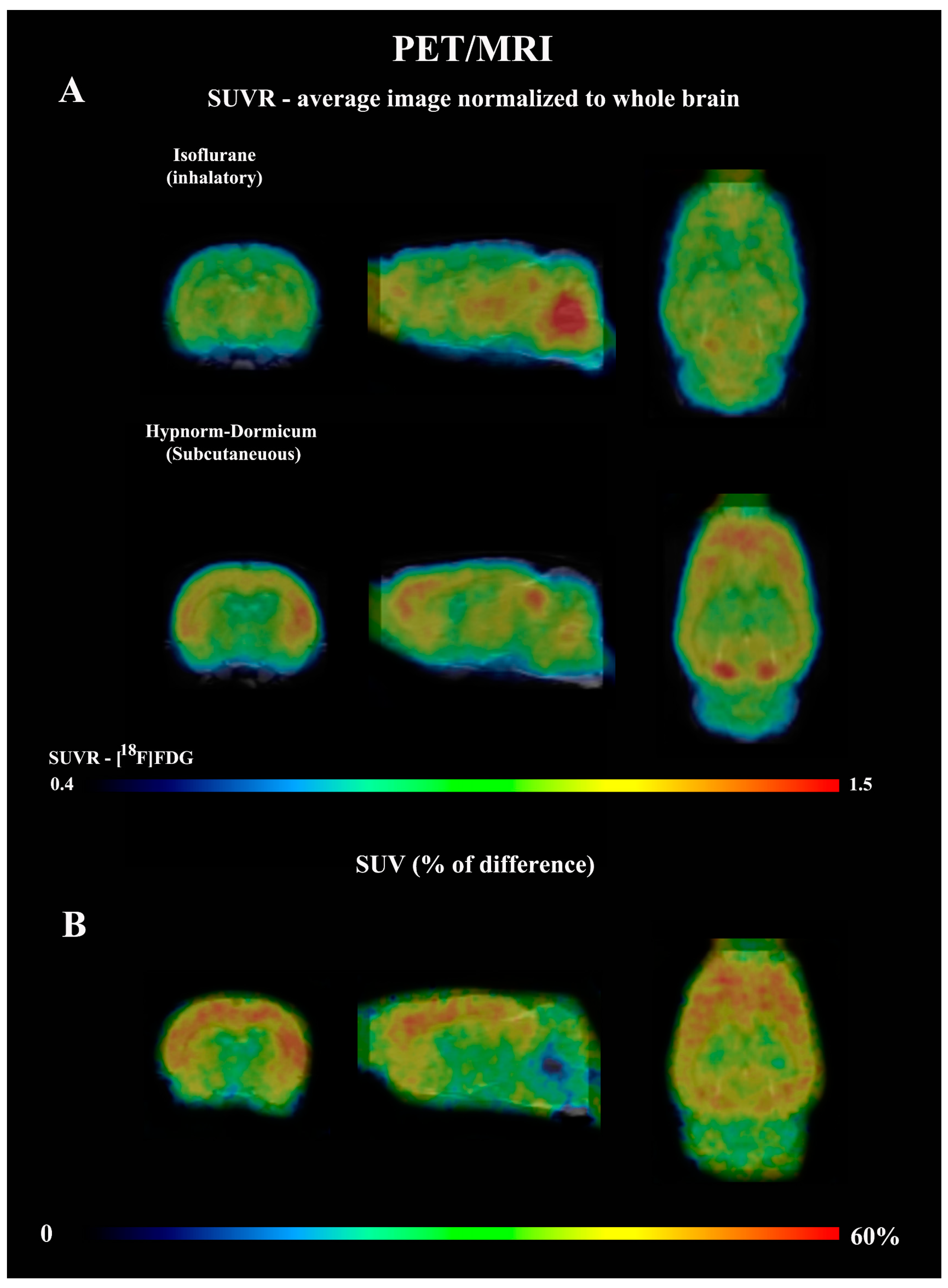 Tomography 11 00004 g002 Tomography 11 00004 g002