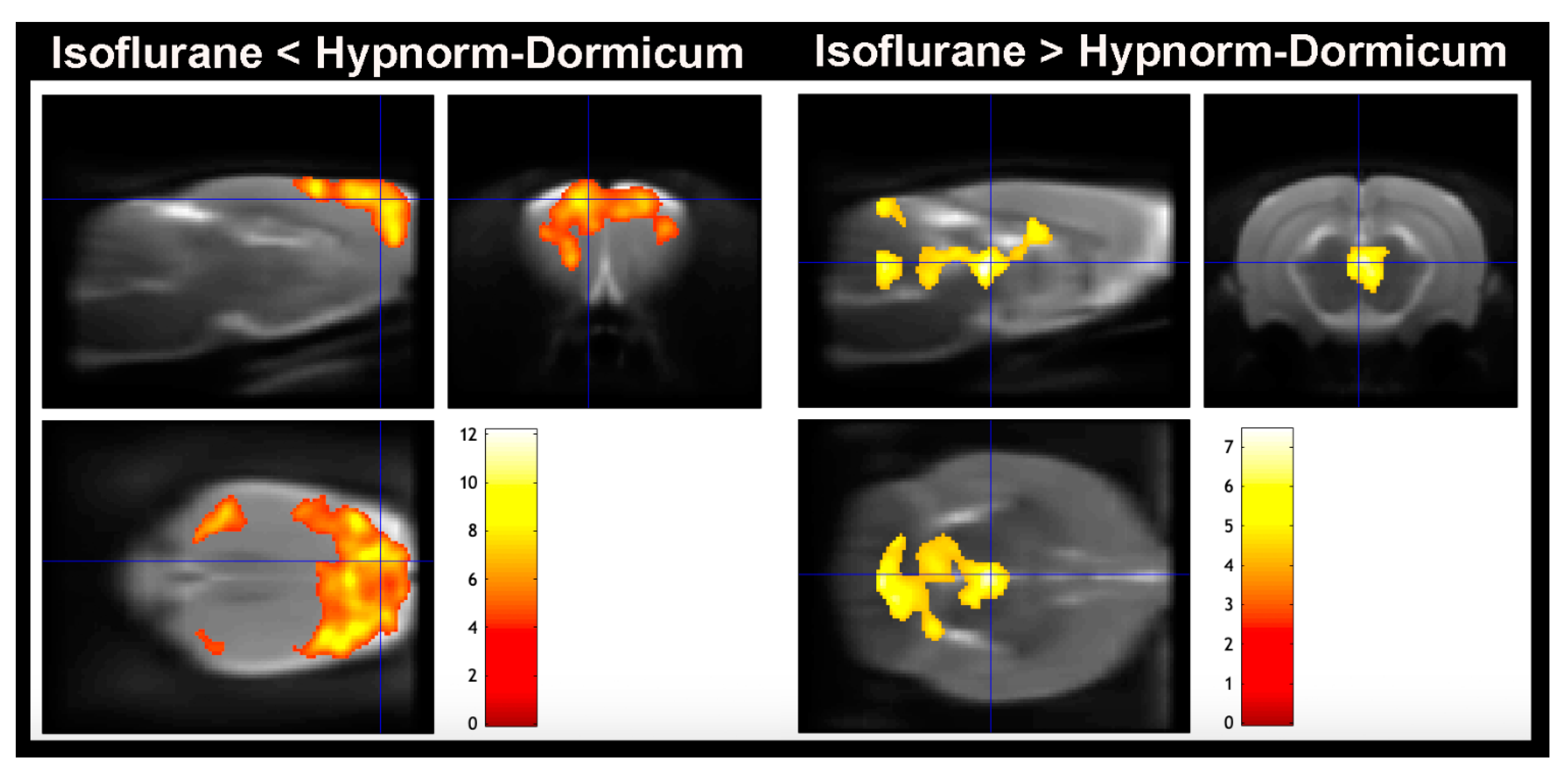 Tomography 11 00004 g004 Tomography 11 00004 g004