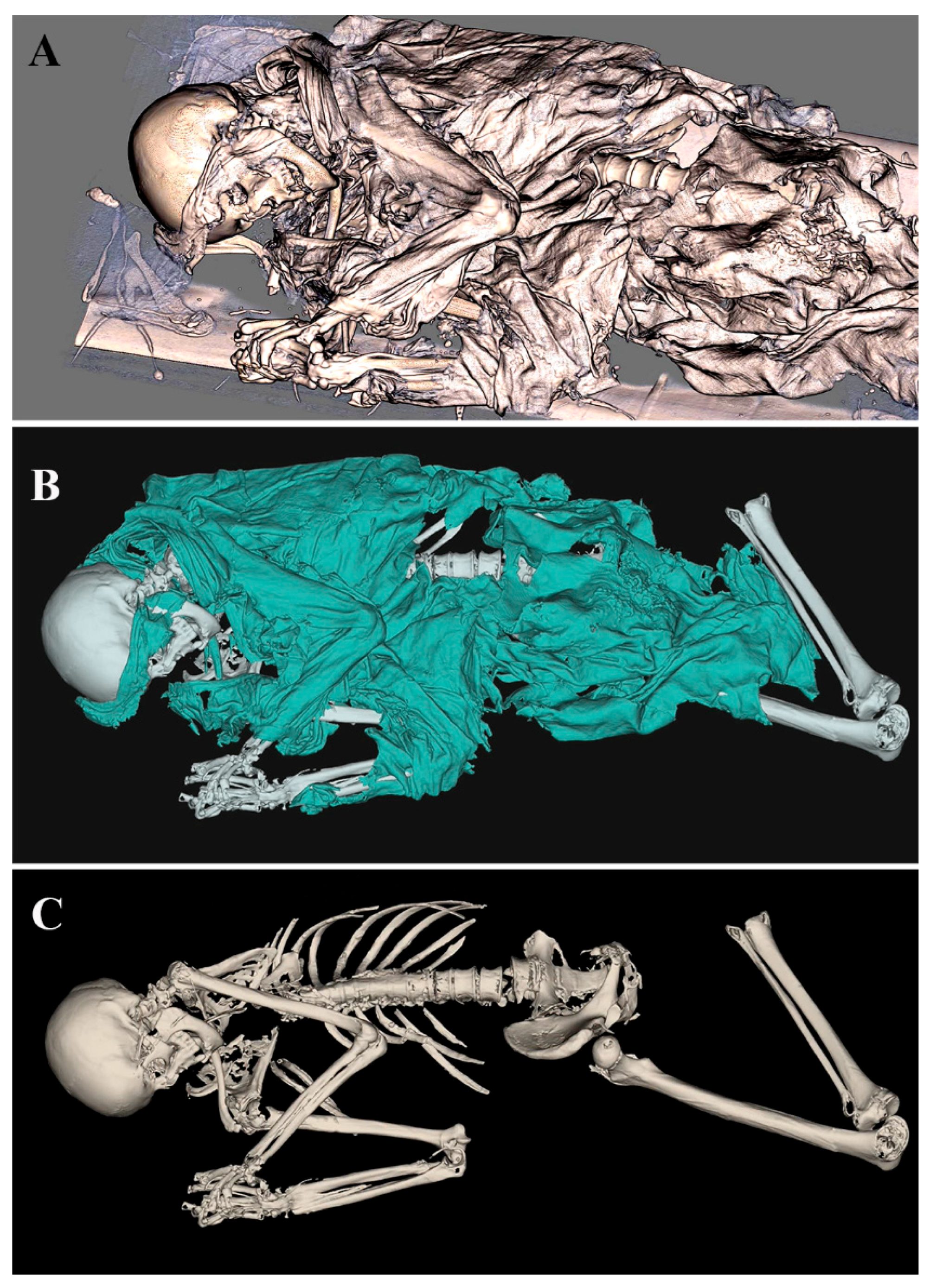 Tomography 11 00005 g002
