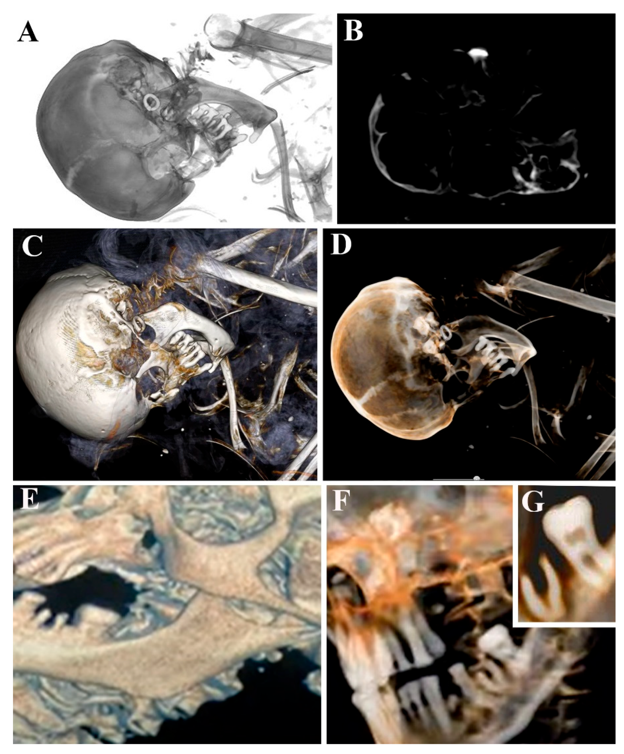Tomography 11 00005 g003