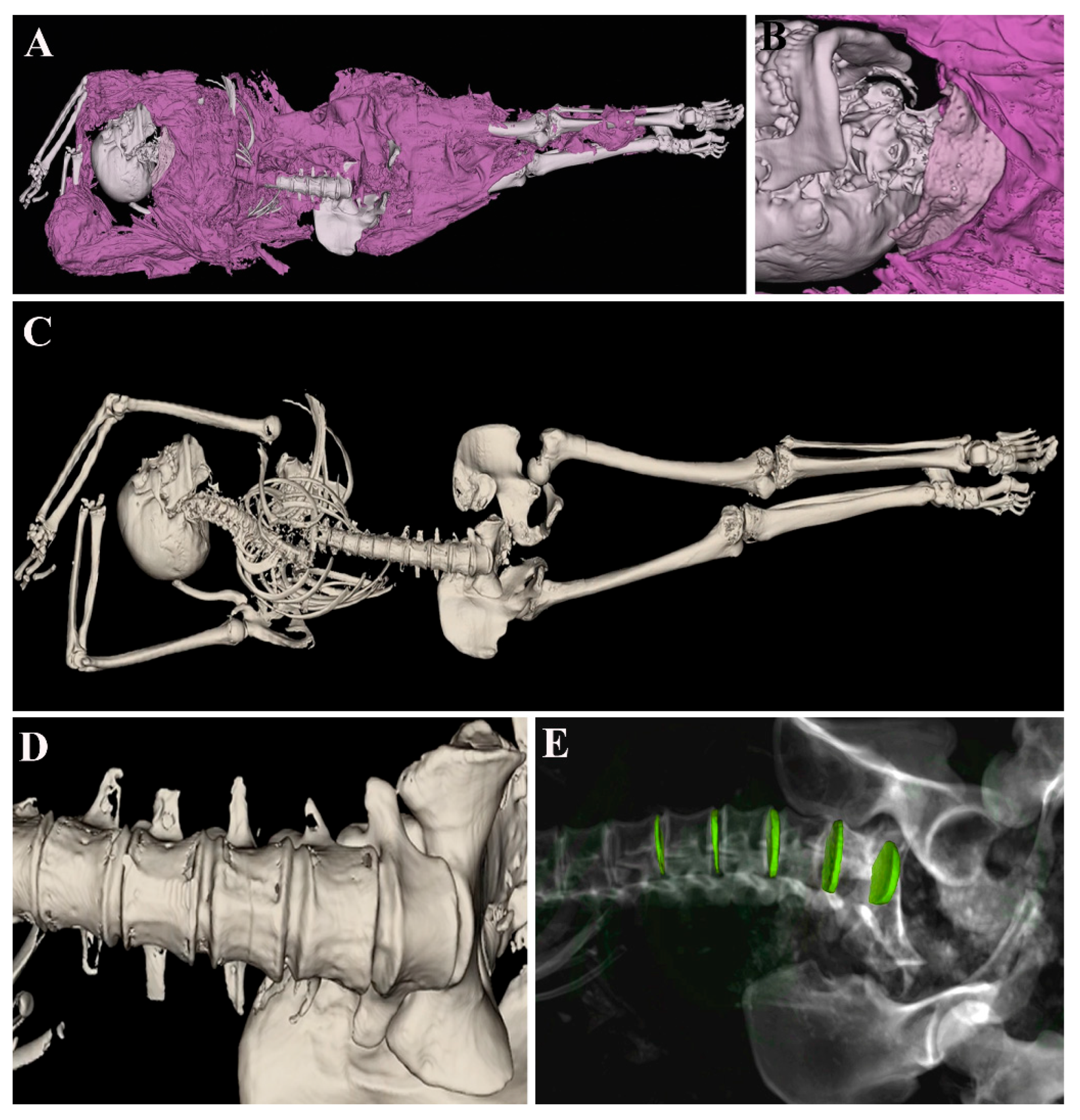 Tomography 11 00005 g004