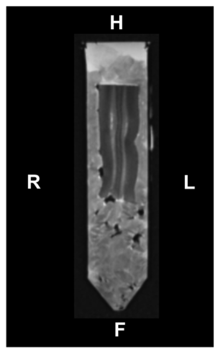 Tomography 11 00008 g001