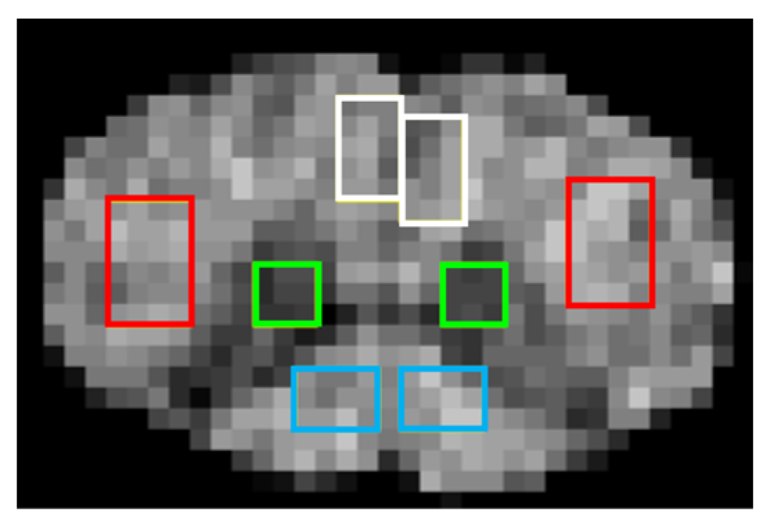Tomography 11 00008 g002