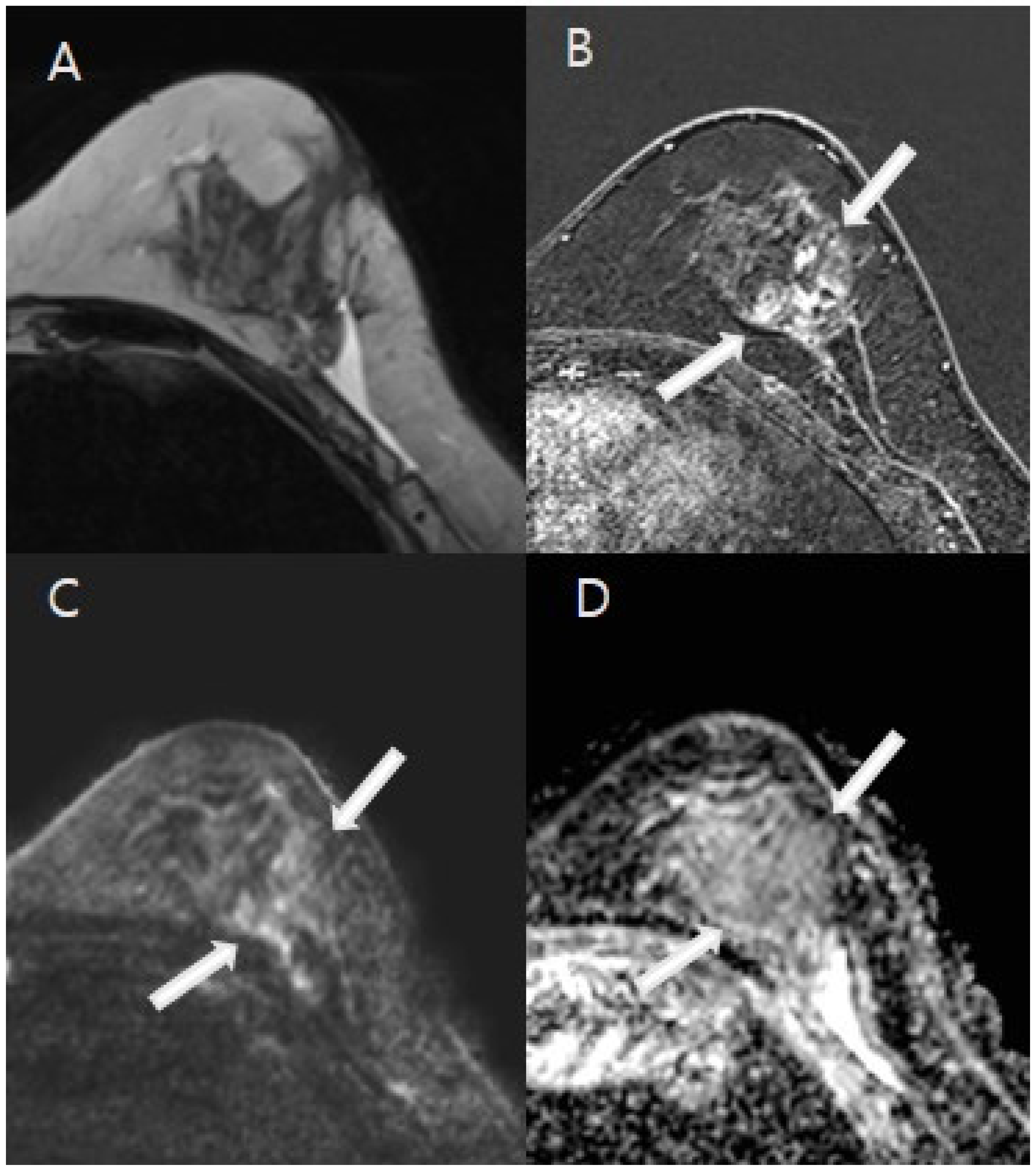 Tomography 11 00010 g003