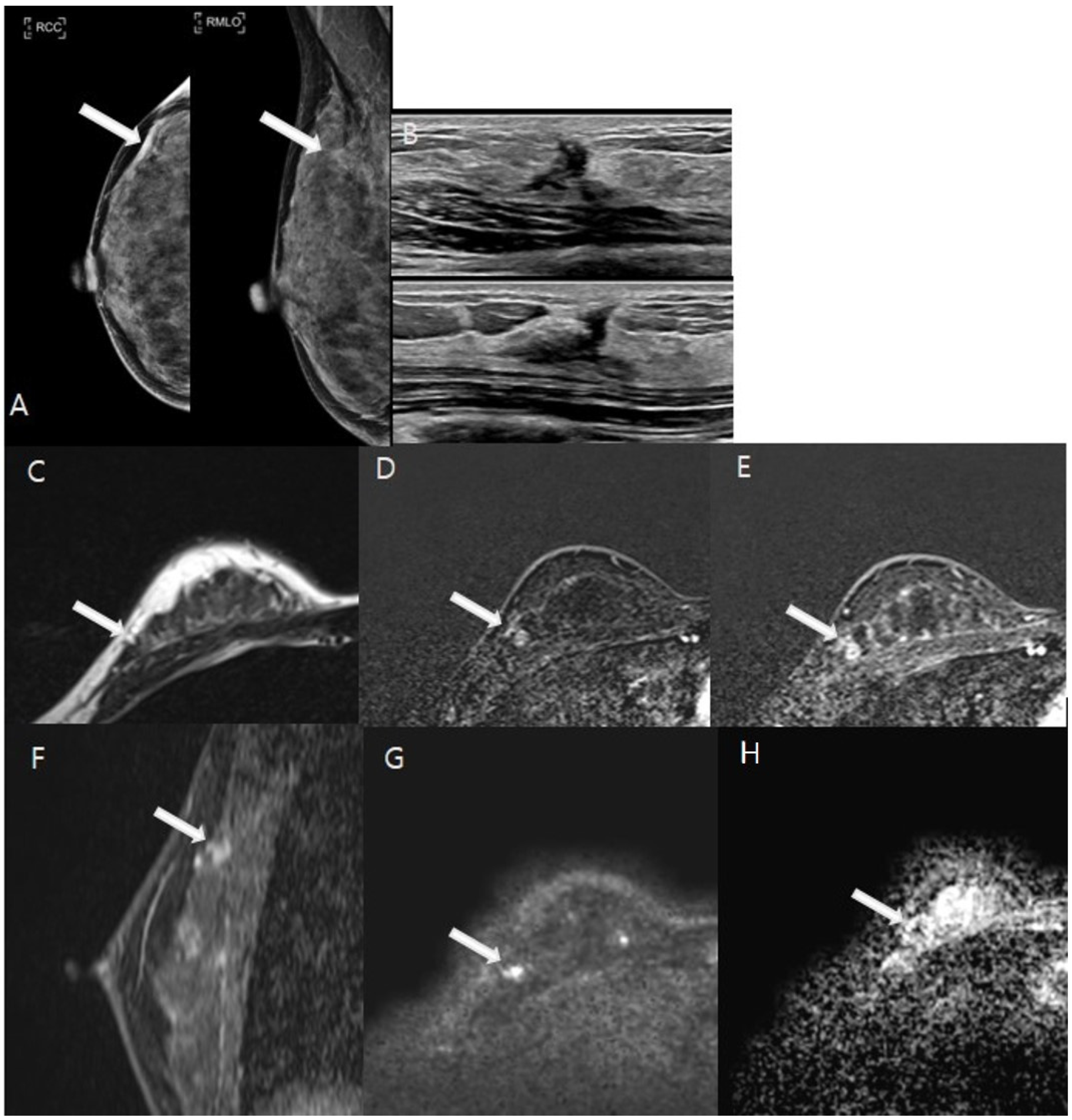 Tomography 11 00010 g004