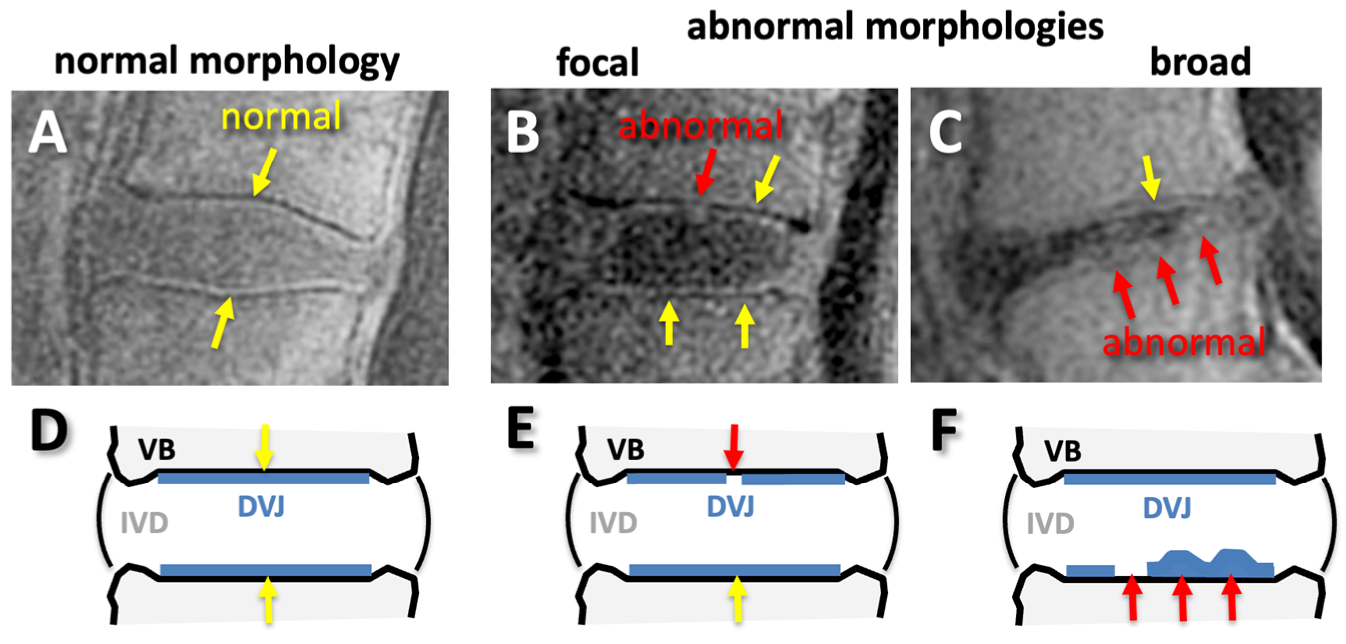 Tomography 11 00012 g004