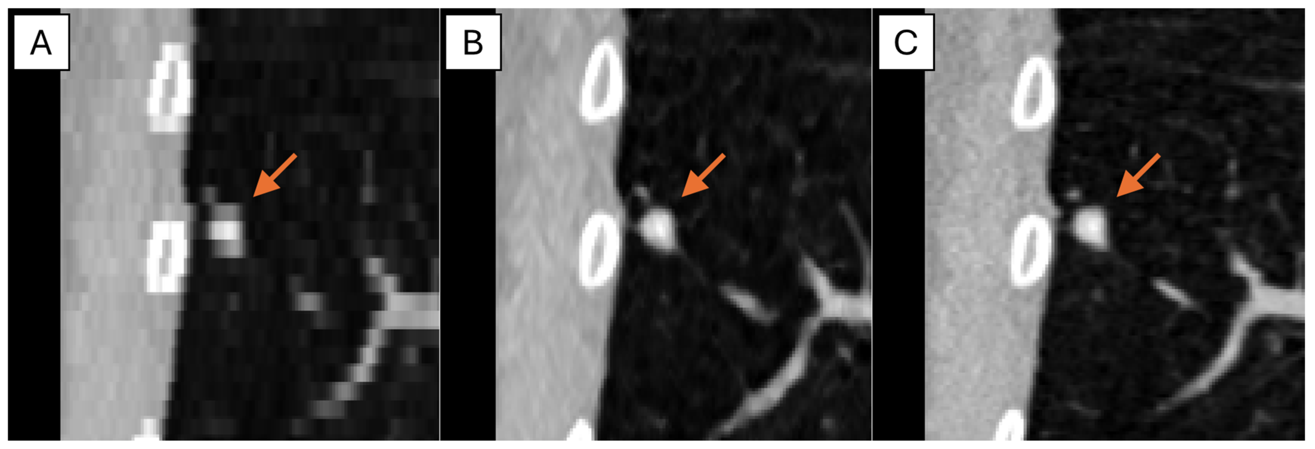 Tomography 11 00013 g005