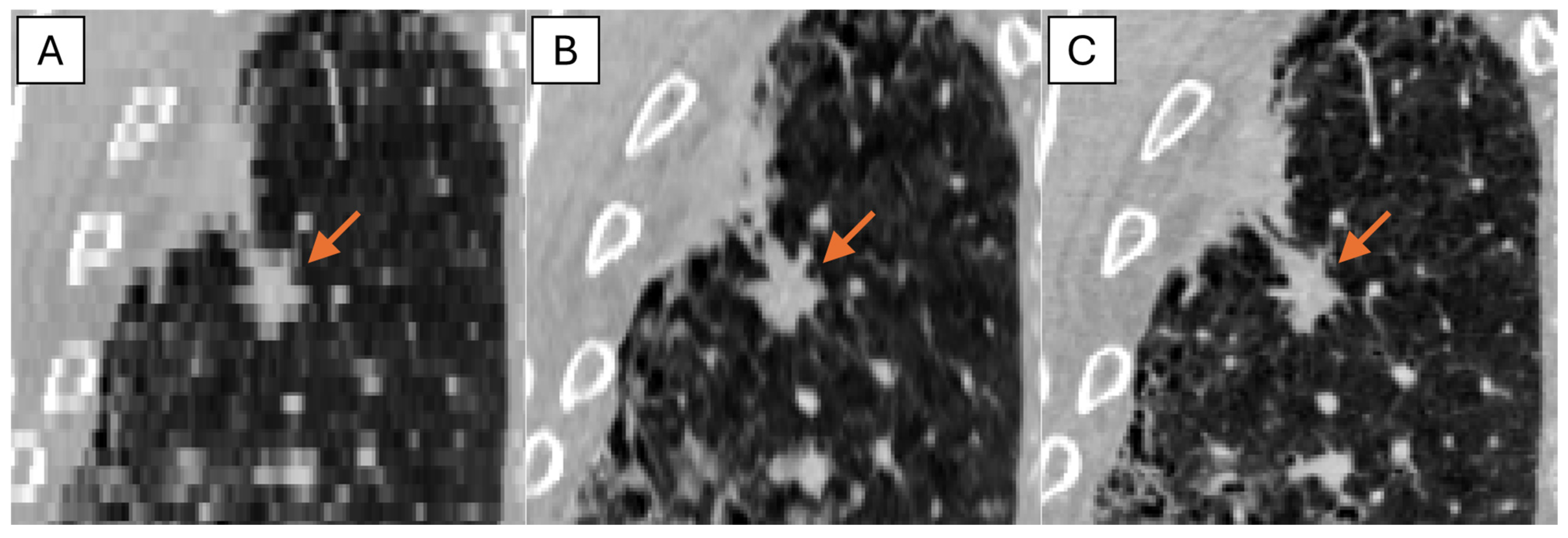 Tomography 11 00013 g006