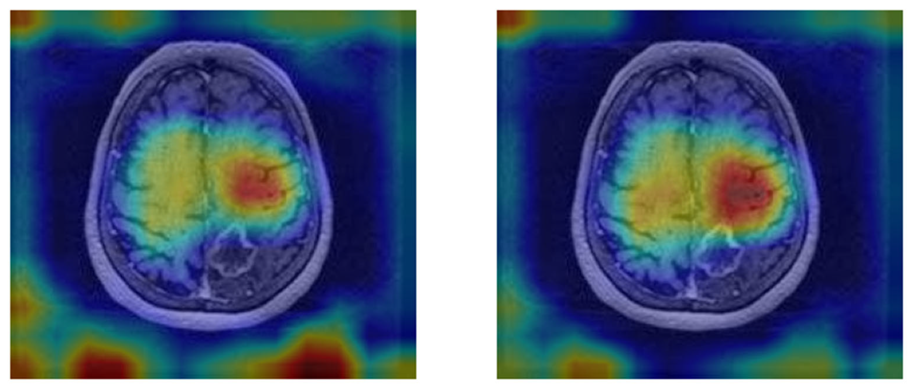 Tomography 11 00015 g007