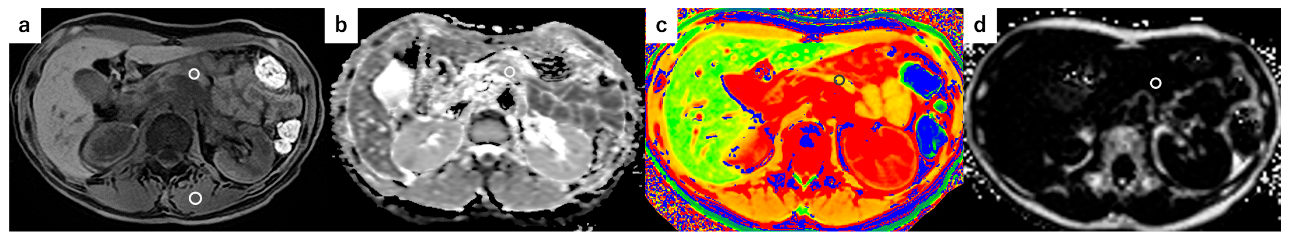 Tomography 11 00016 g002