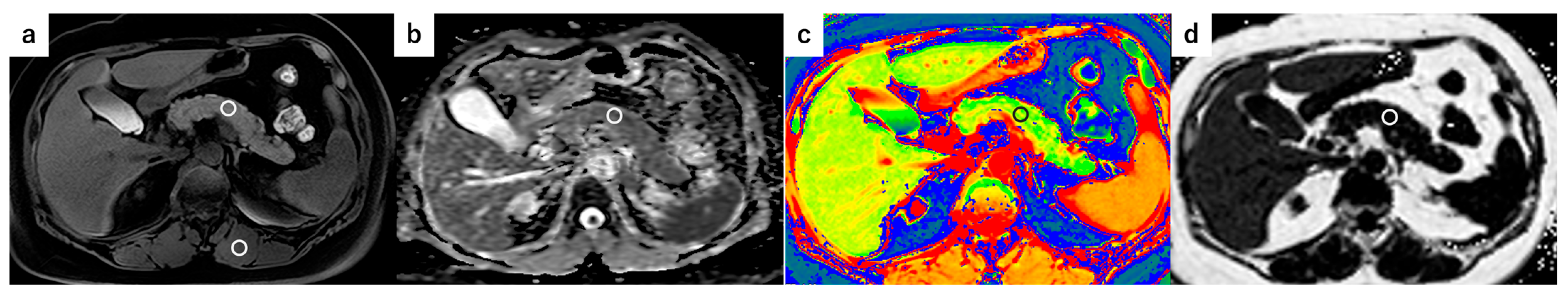 Tomography 11 00016 g003