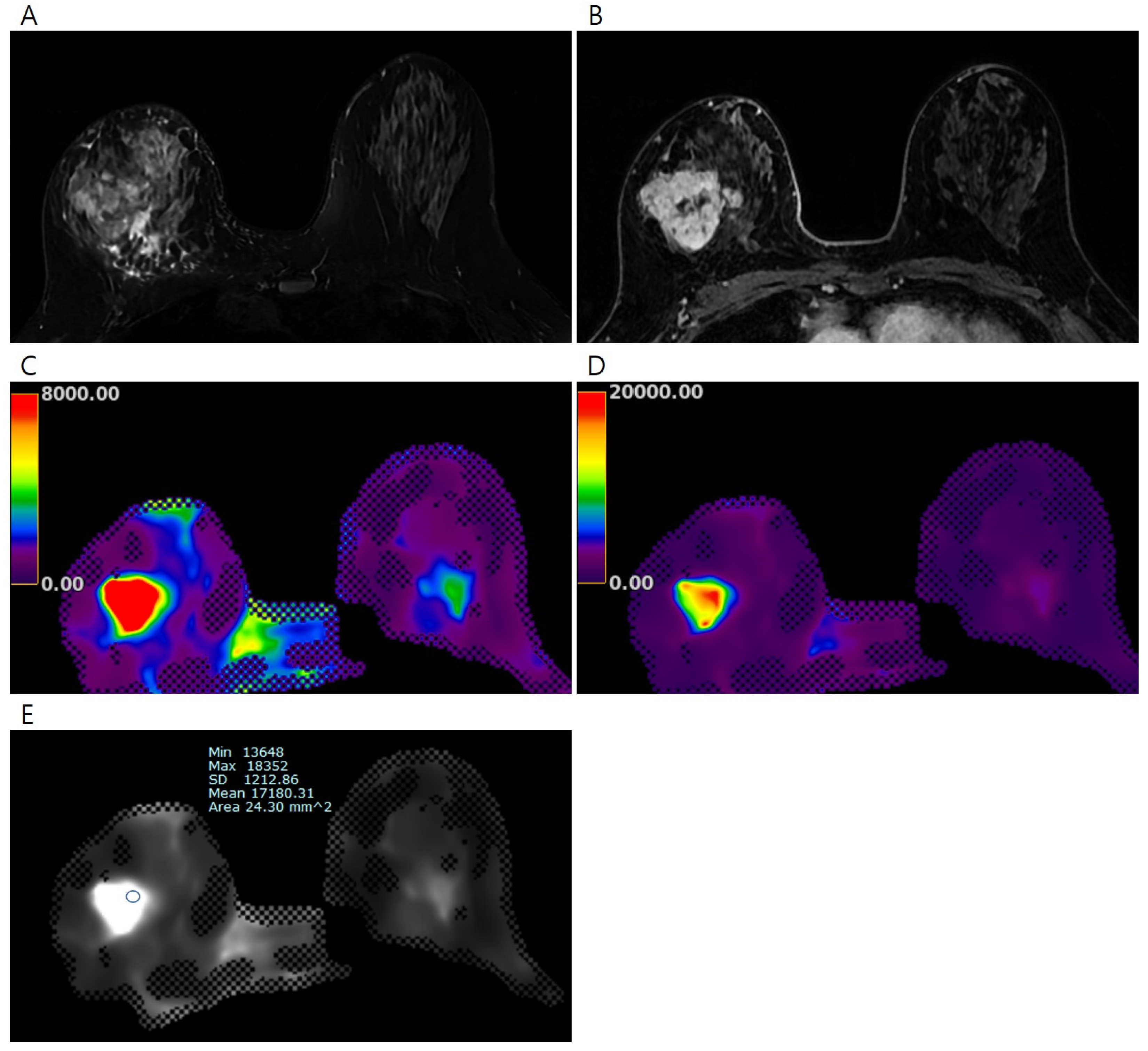Tomography 11 00018 g002