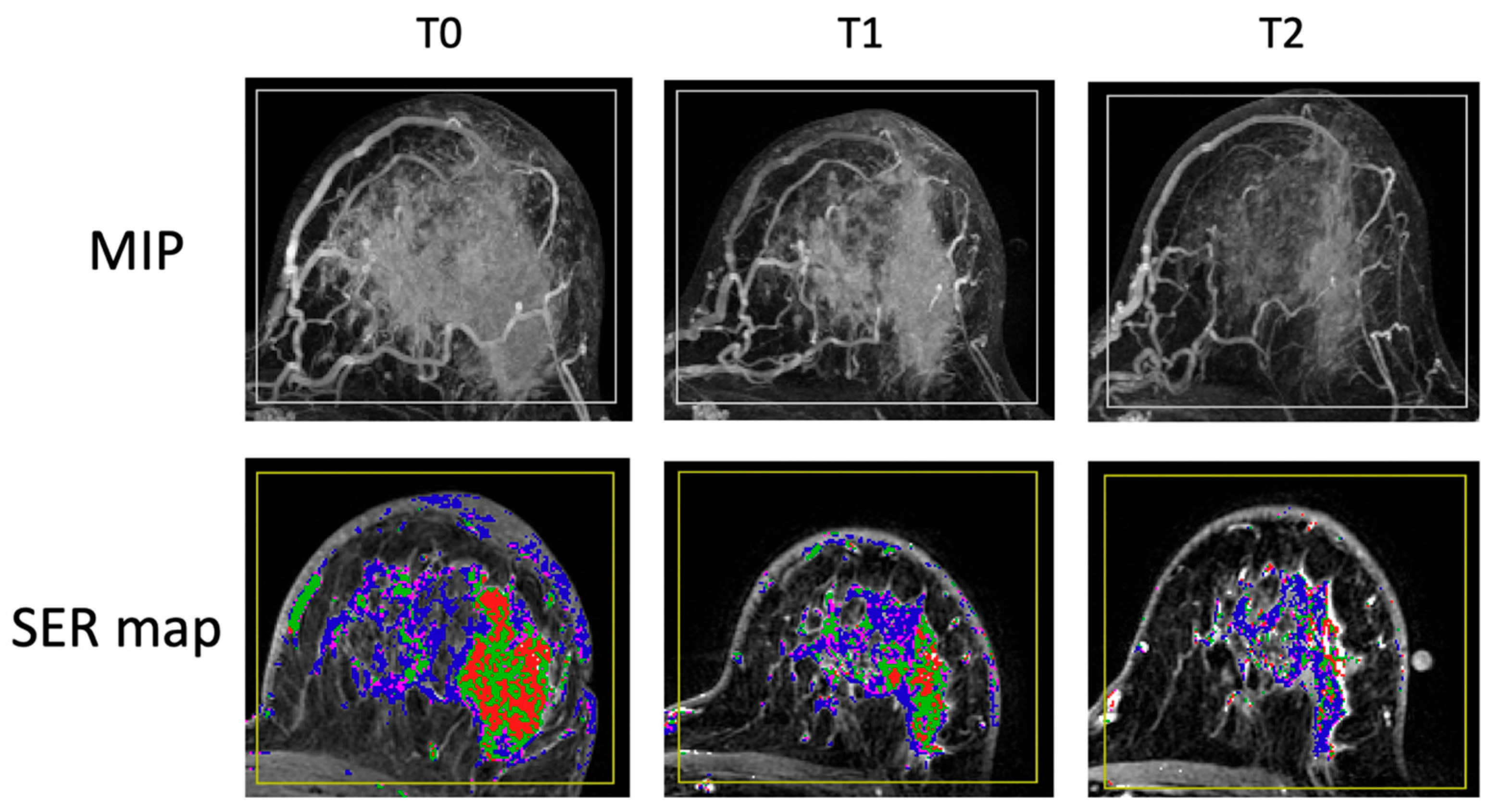 Tomography 11 00026 g003