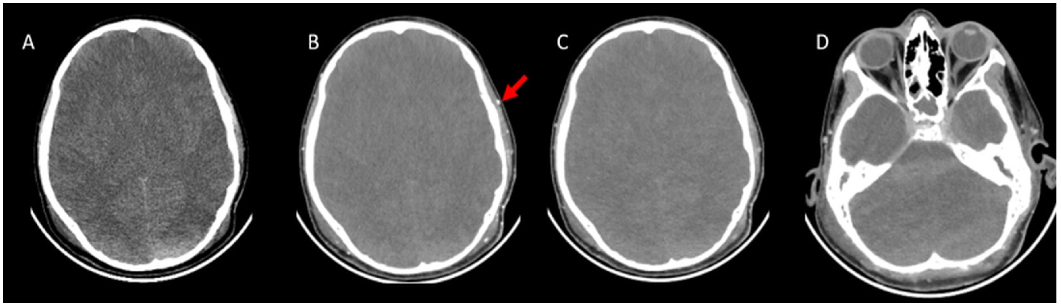 Tomography 11 00030 g002