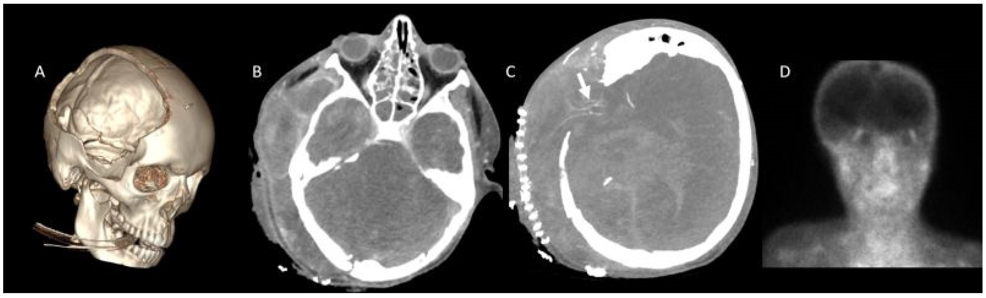 Tomography 11 00030 g003