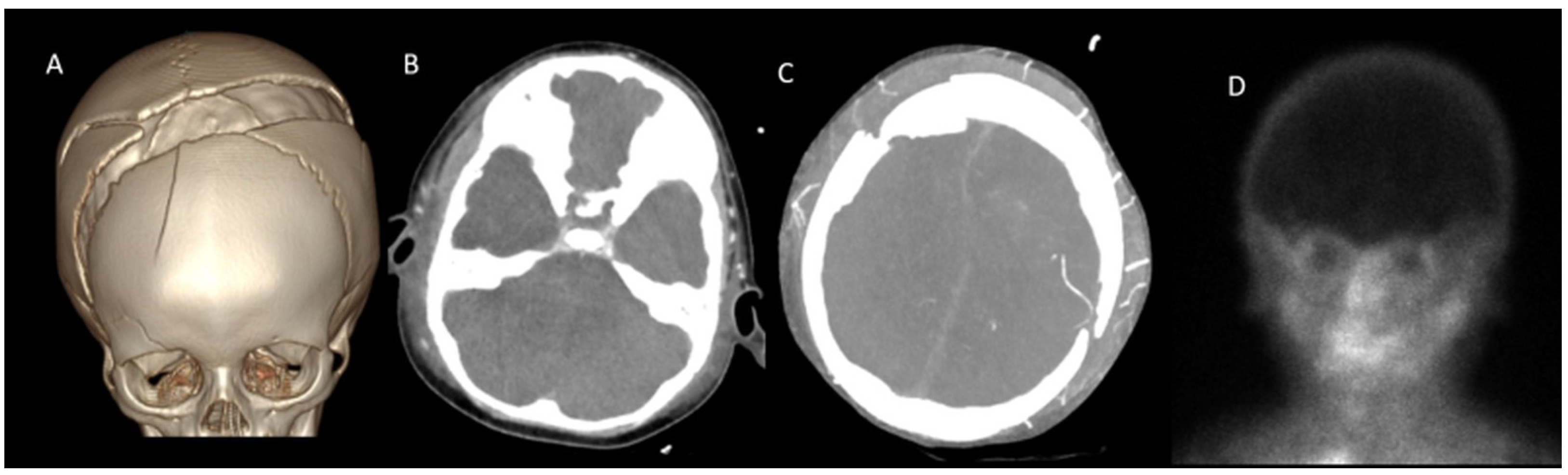 Tomography 11 00030 g004