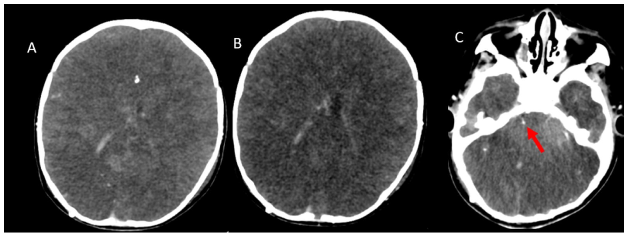 Tomography 11 00030 g005