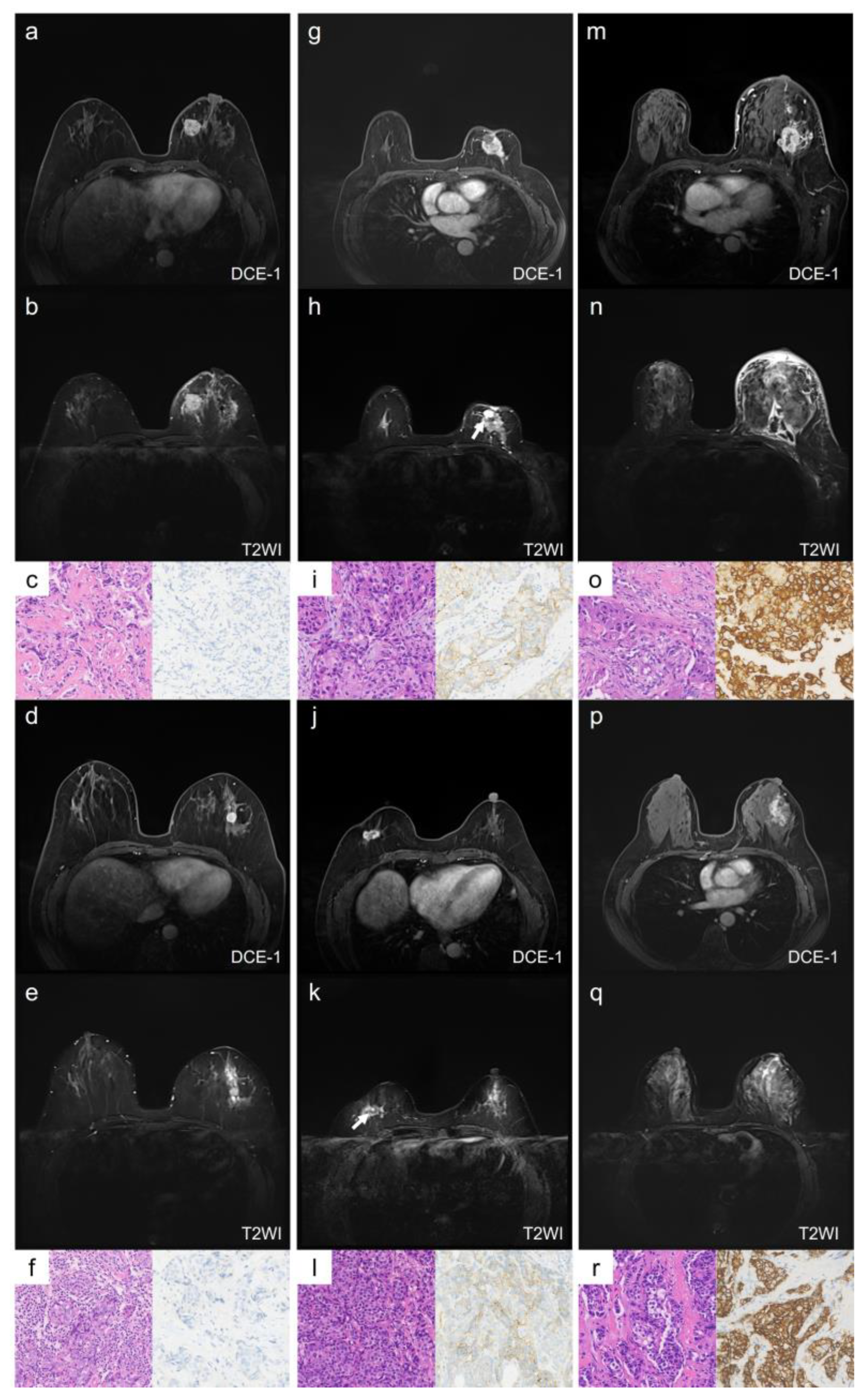 Tomography 11 00031 g002