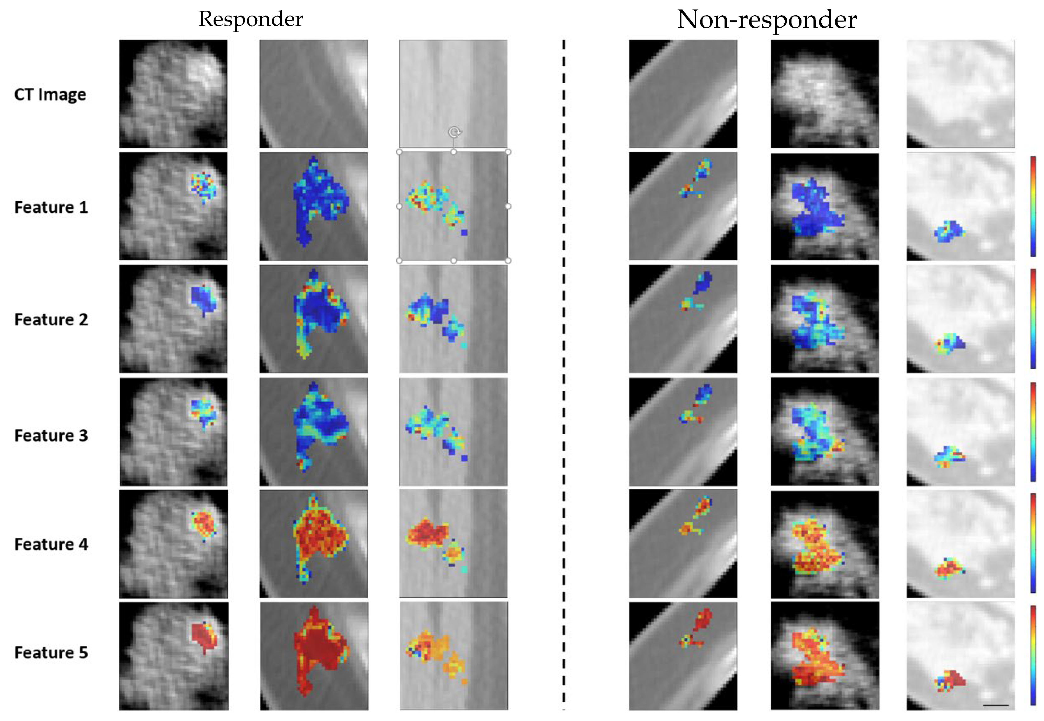 Tomography 11 00033 g003