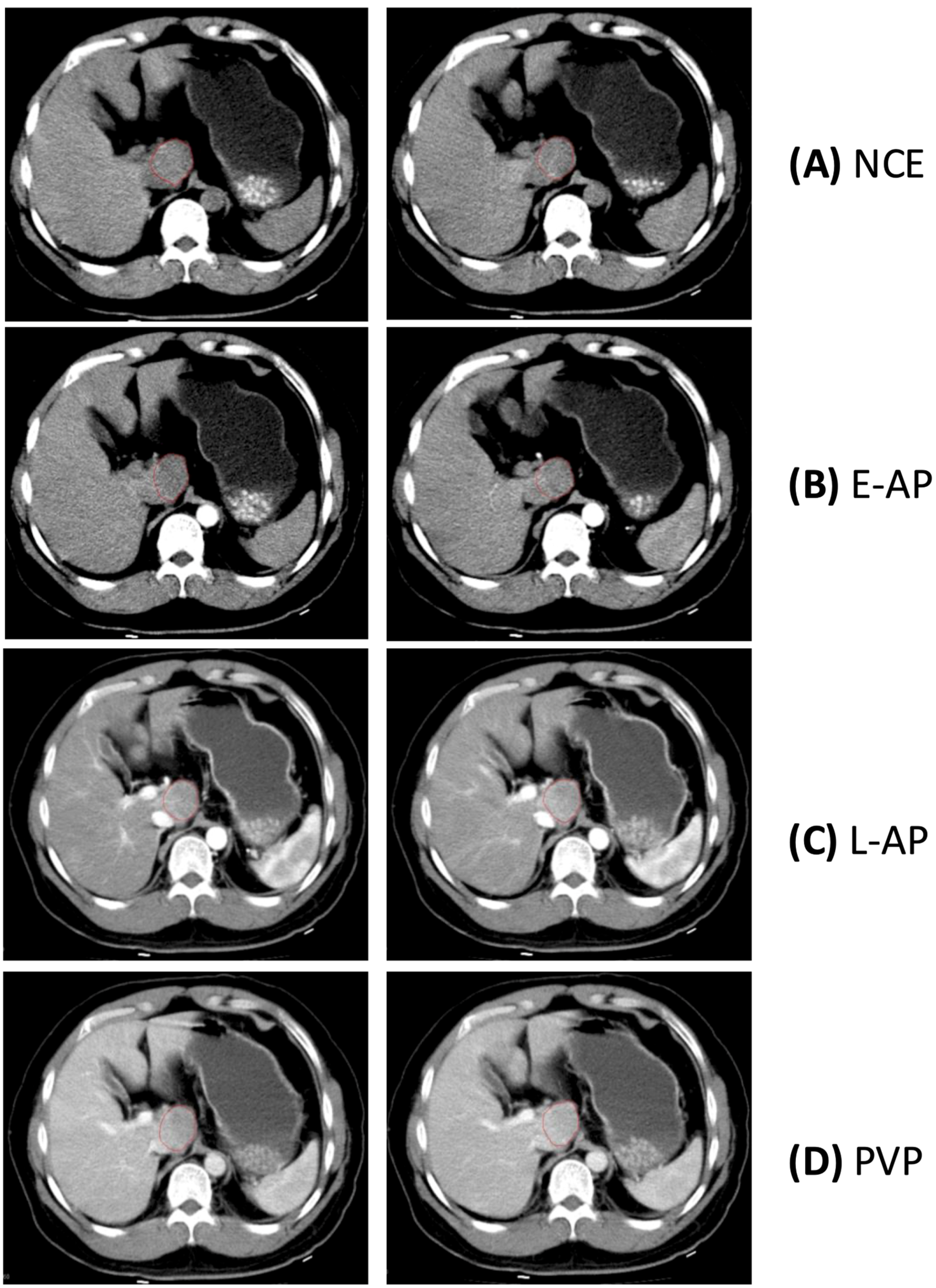 Tomography 11 00036 g001