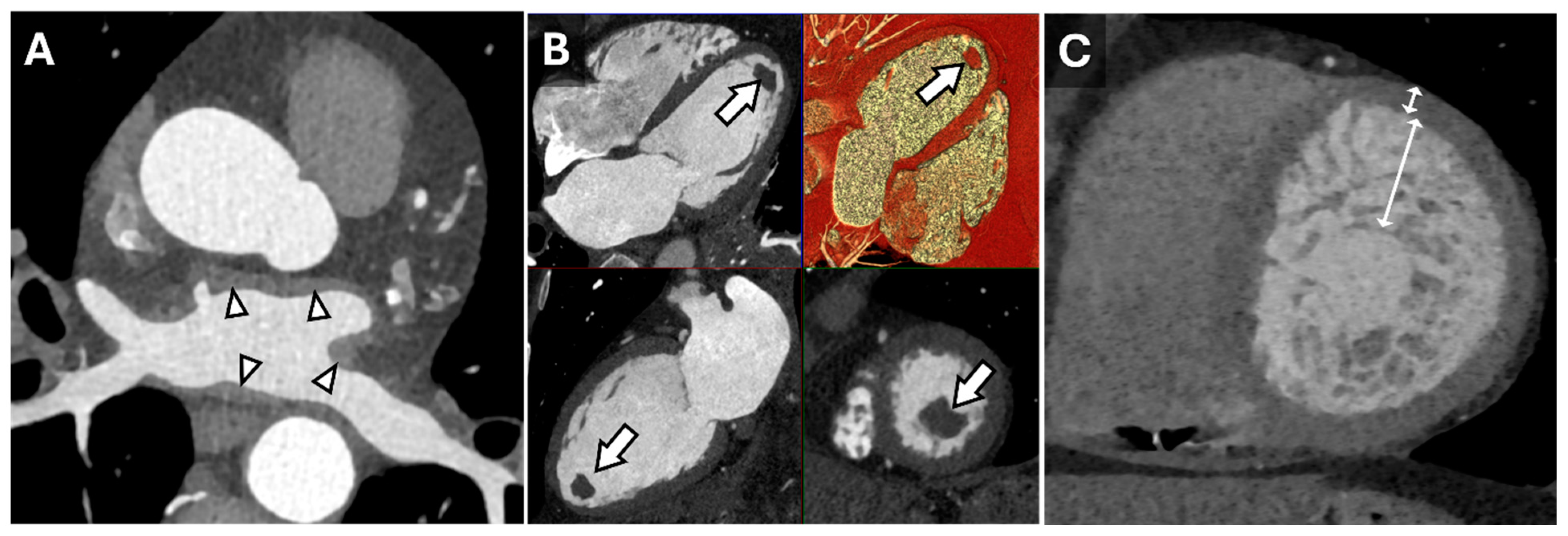 Tomography 11 00039 g001