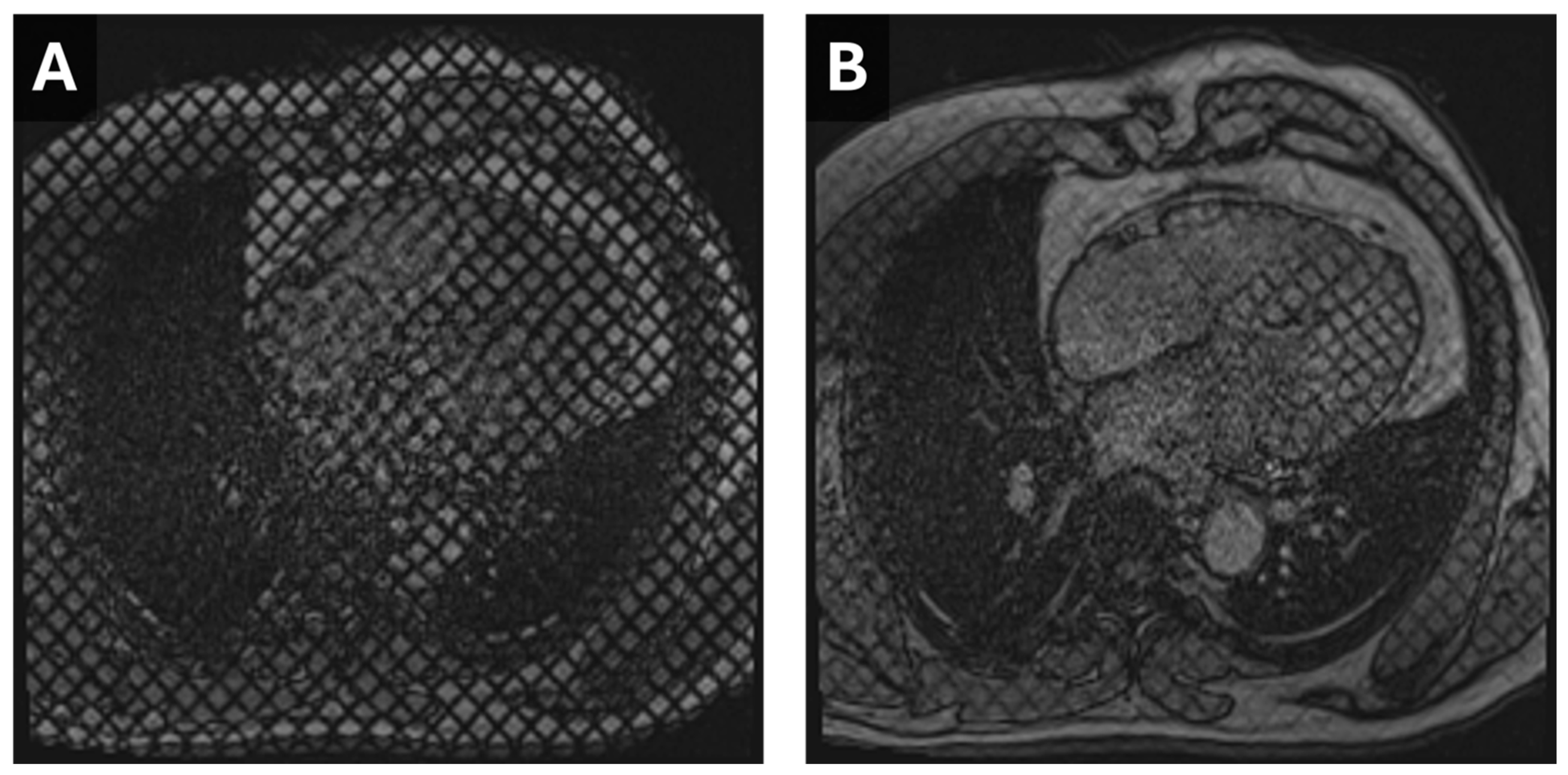 Tomography 11 00039 g003