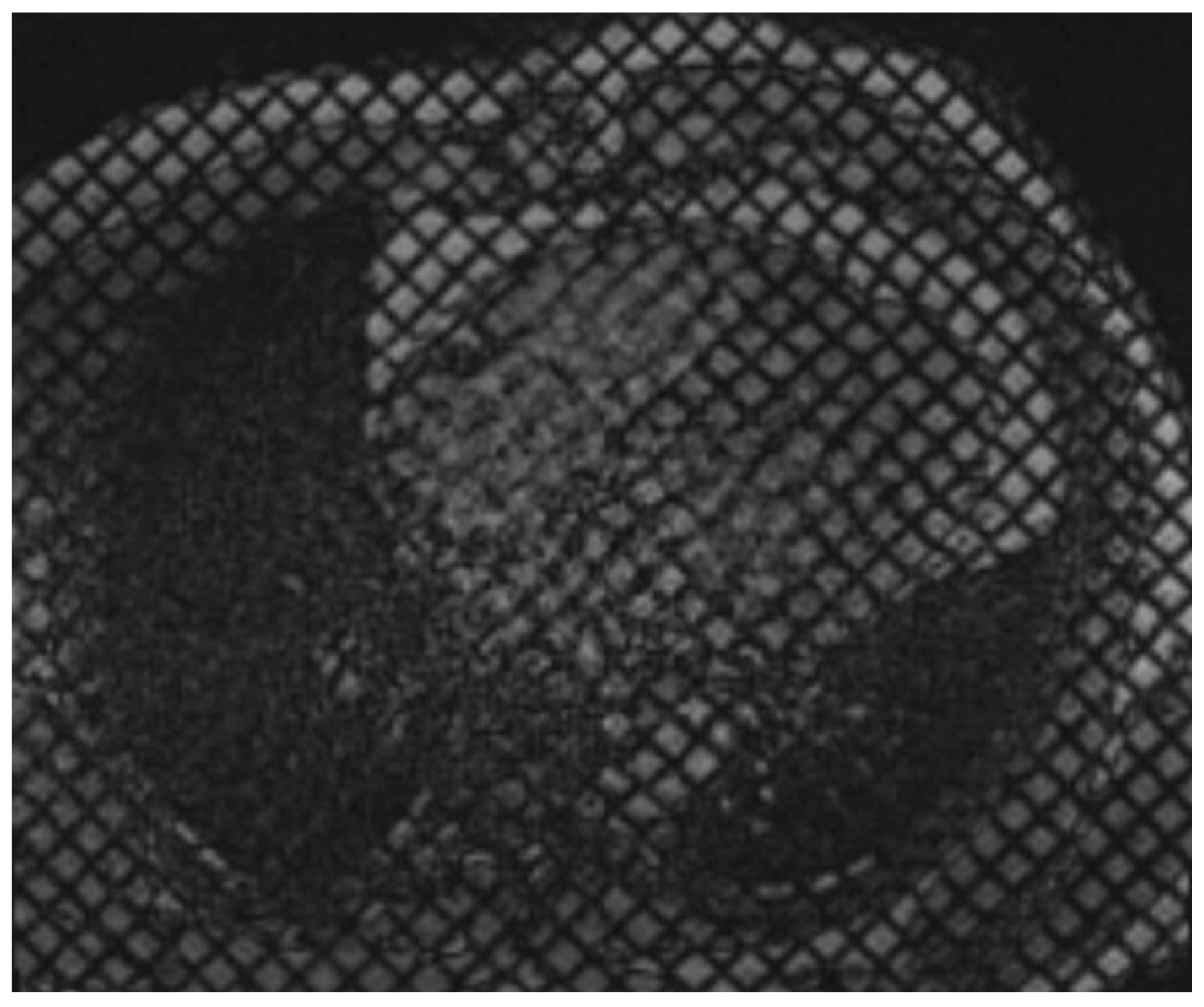 Tomography 11 00039 g004