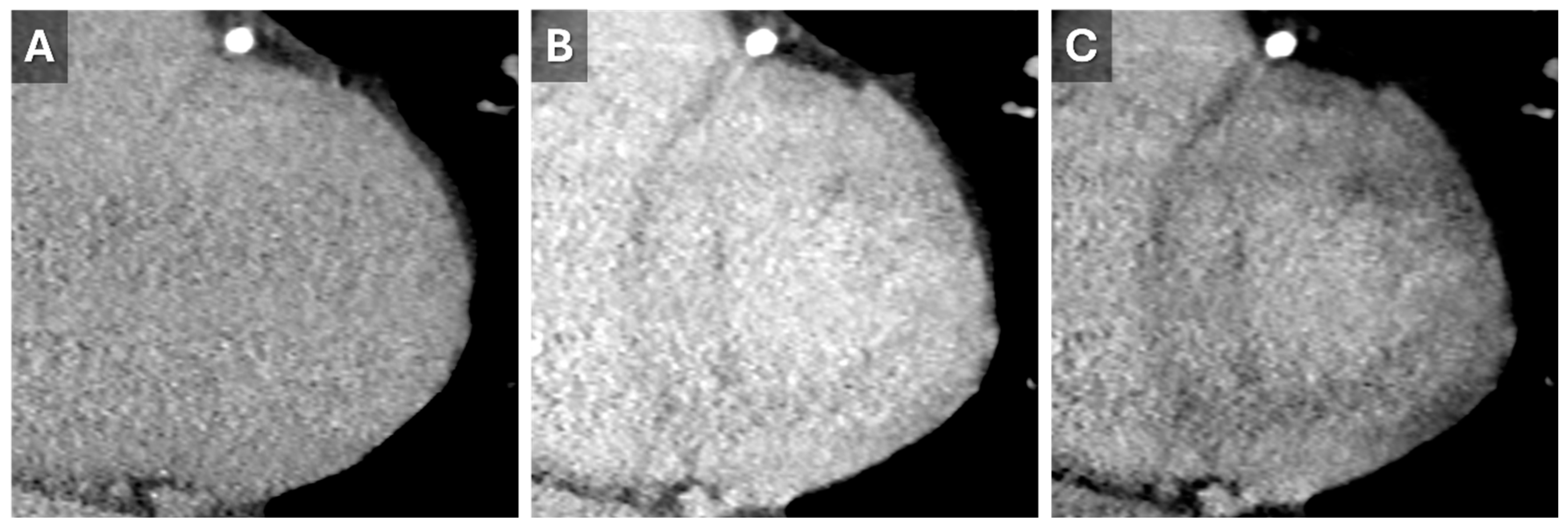 Tomography 11 00039 g006