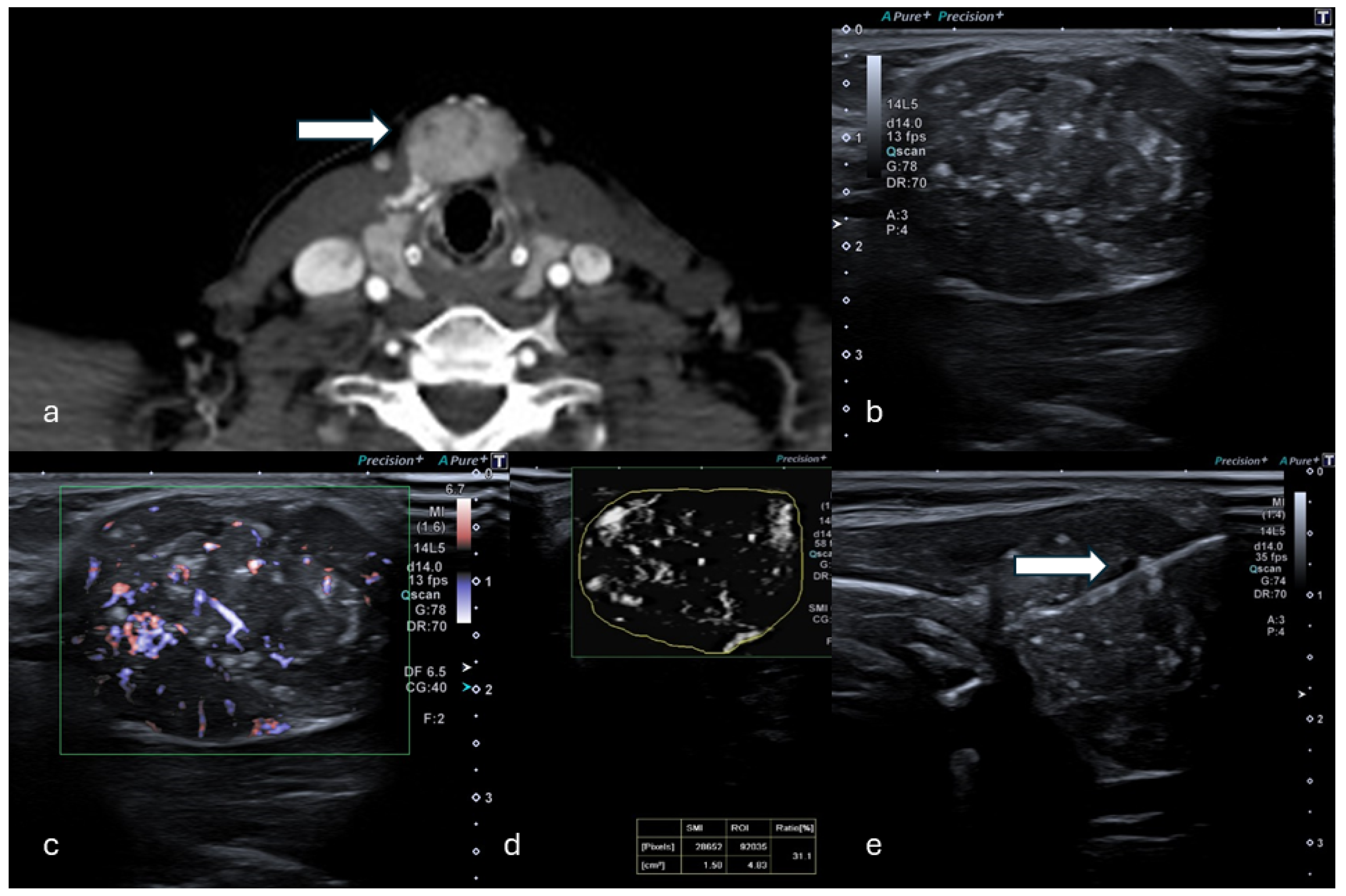 Tomography 11 00043 g002