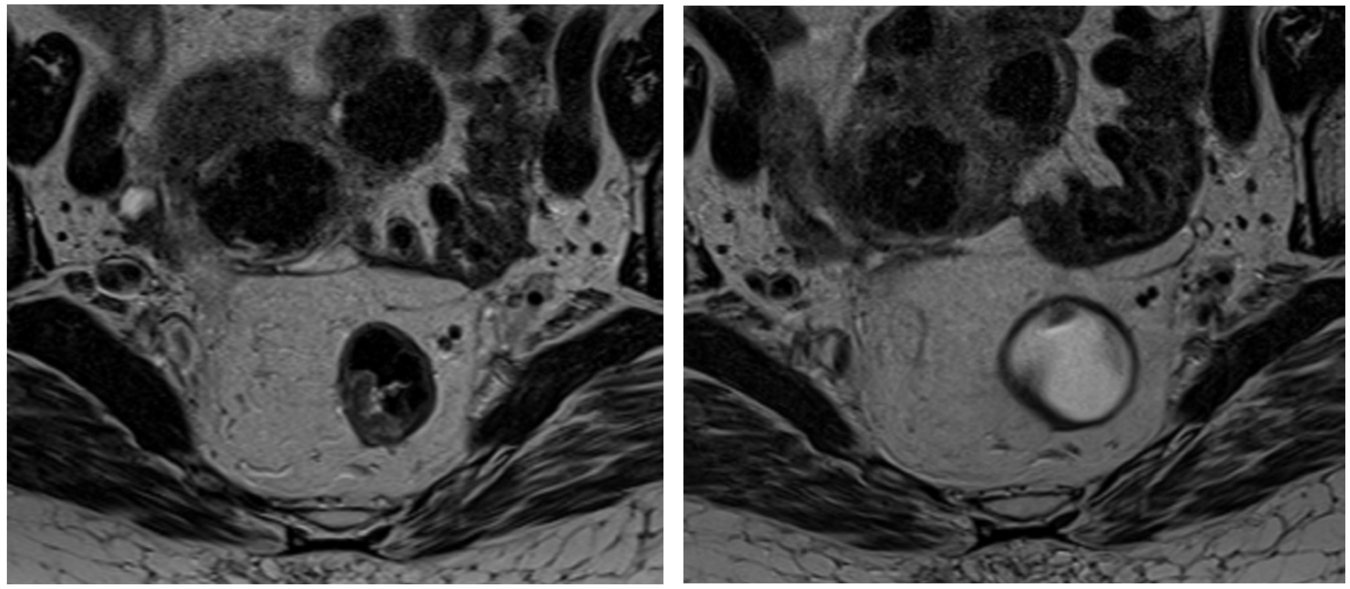 Tomography 11 00044 g001