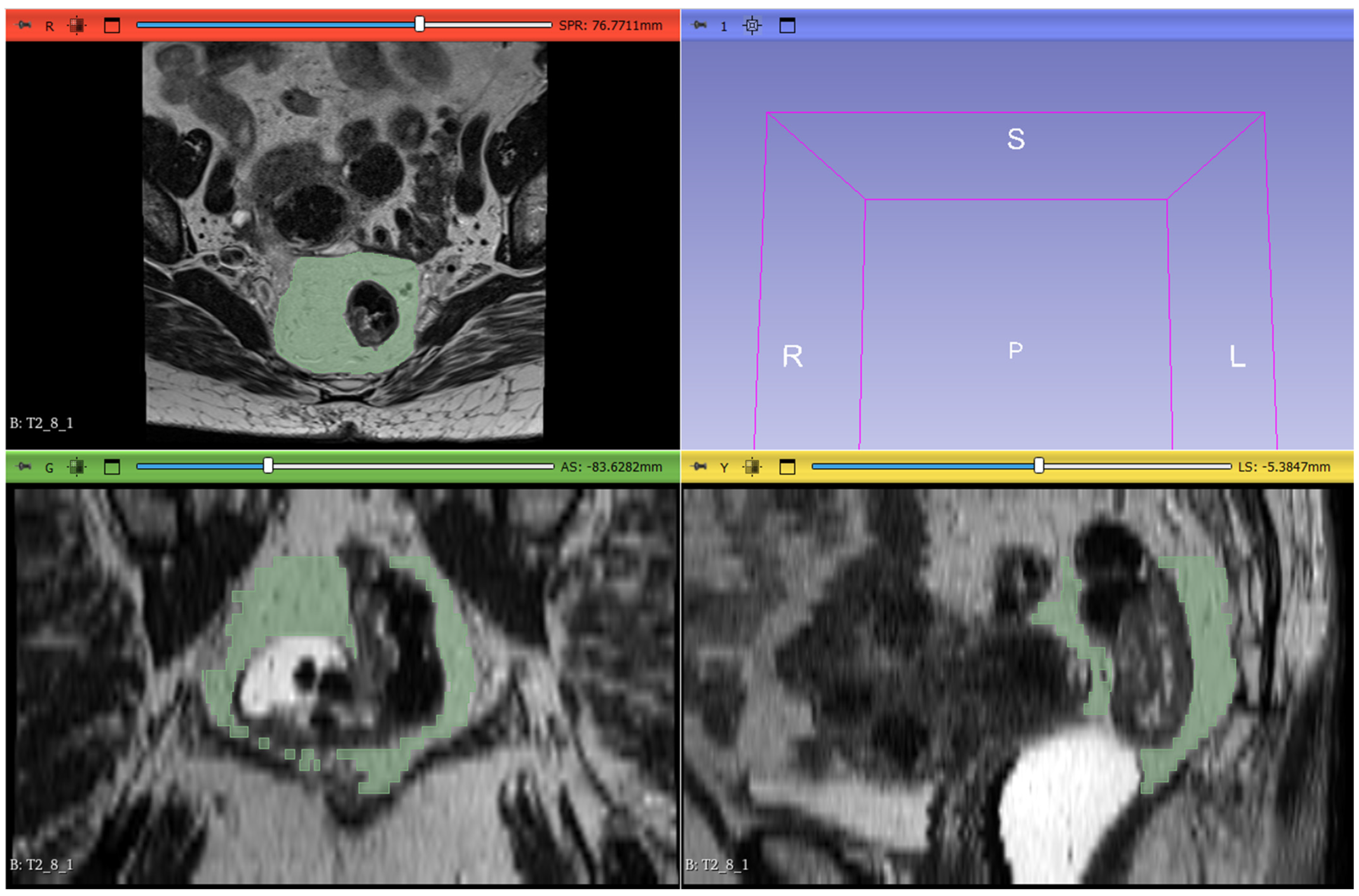 Tomography 11 00044 g002