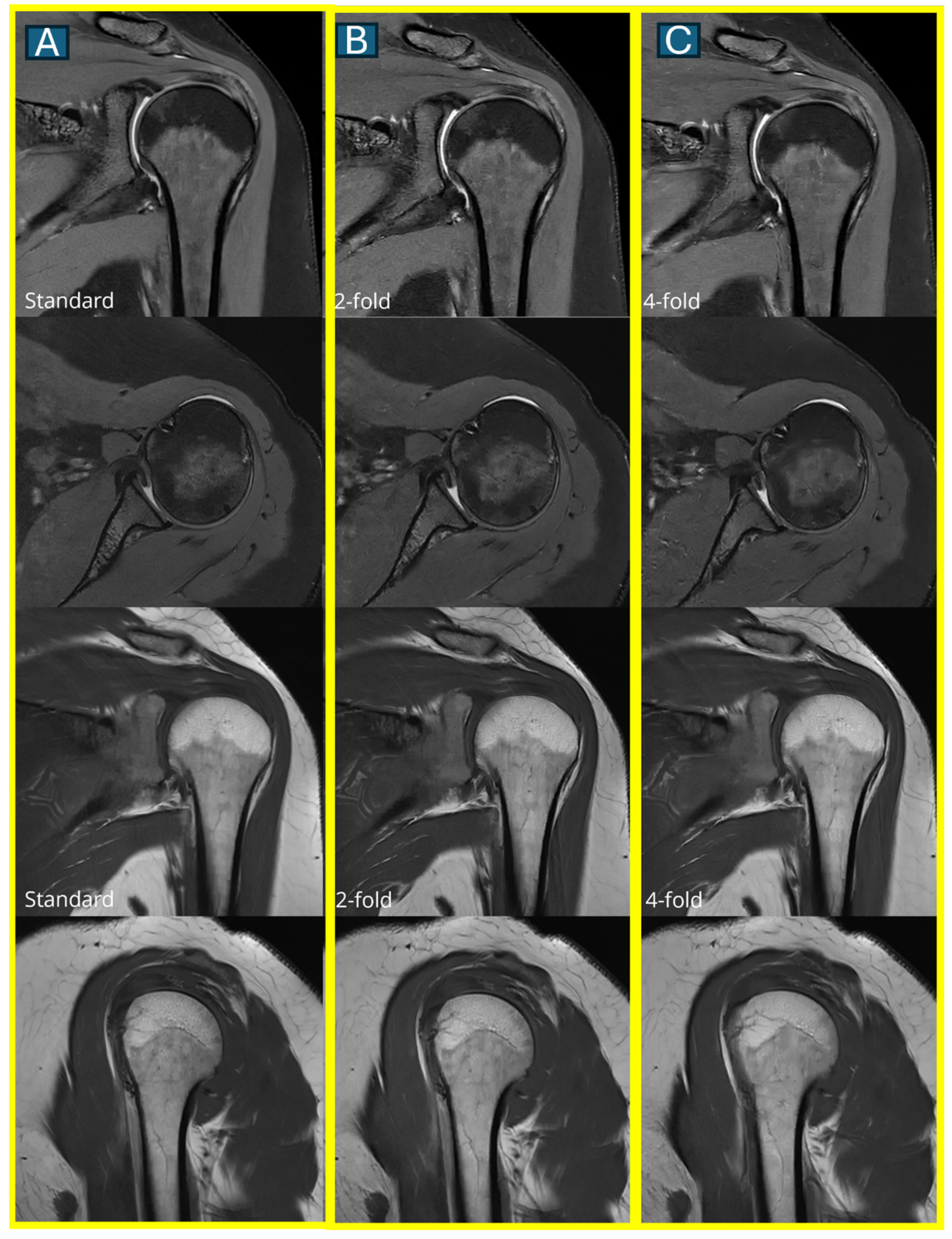 Tomography 11 00048 g004