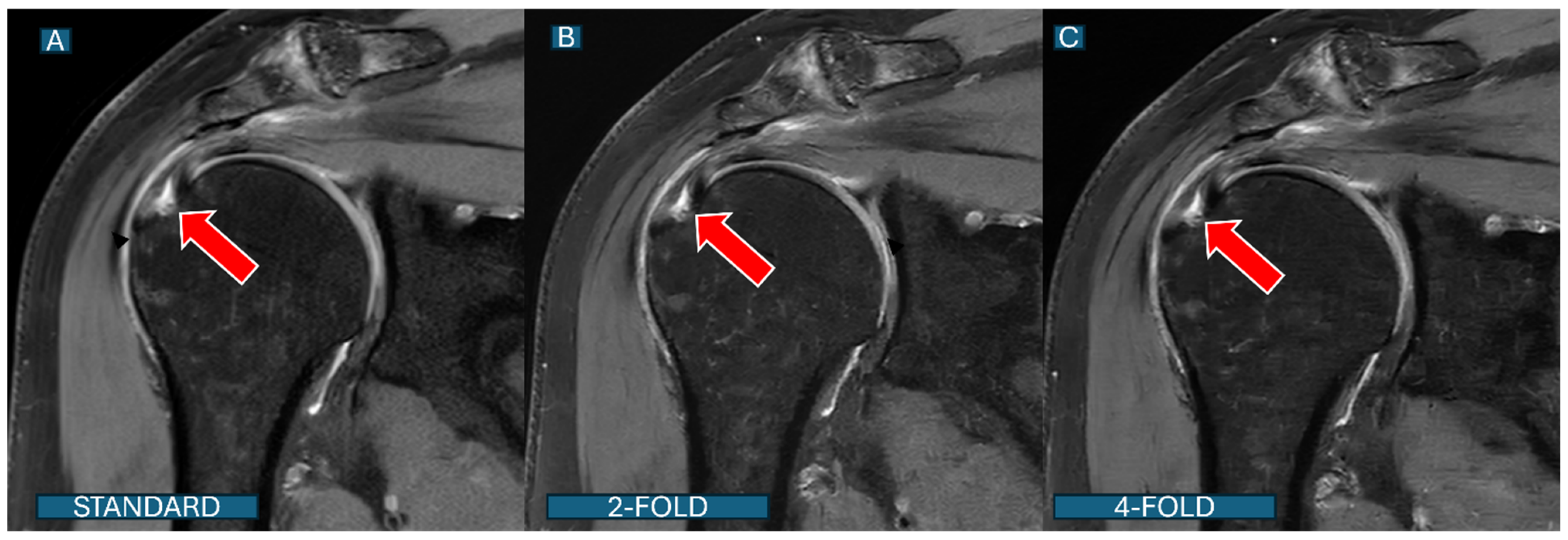Tomography 11 00048 g005