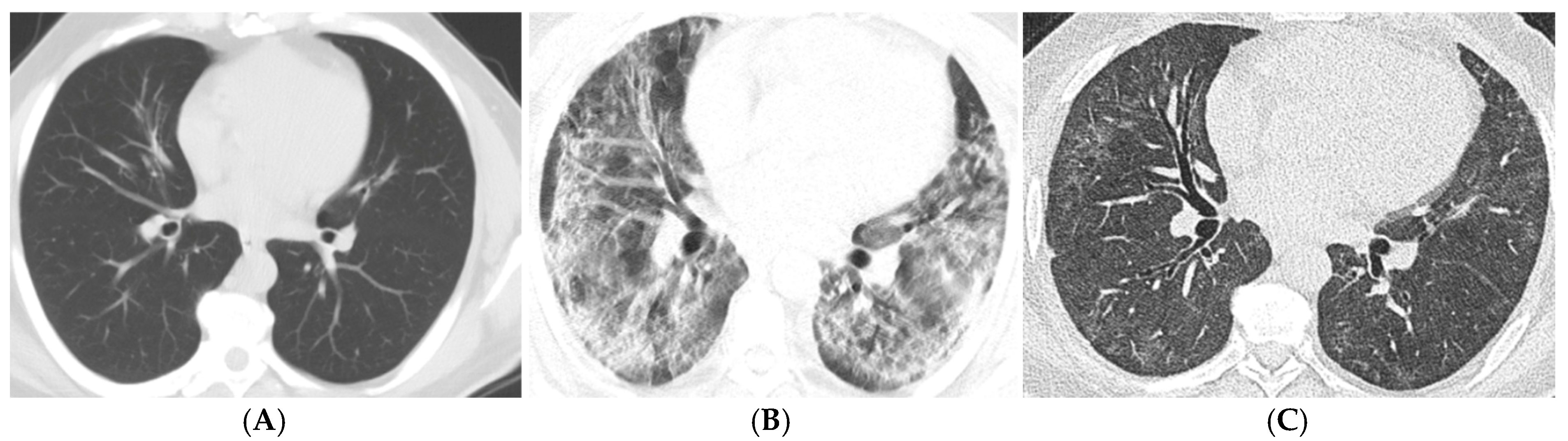 Tomography 11 00049 g001
