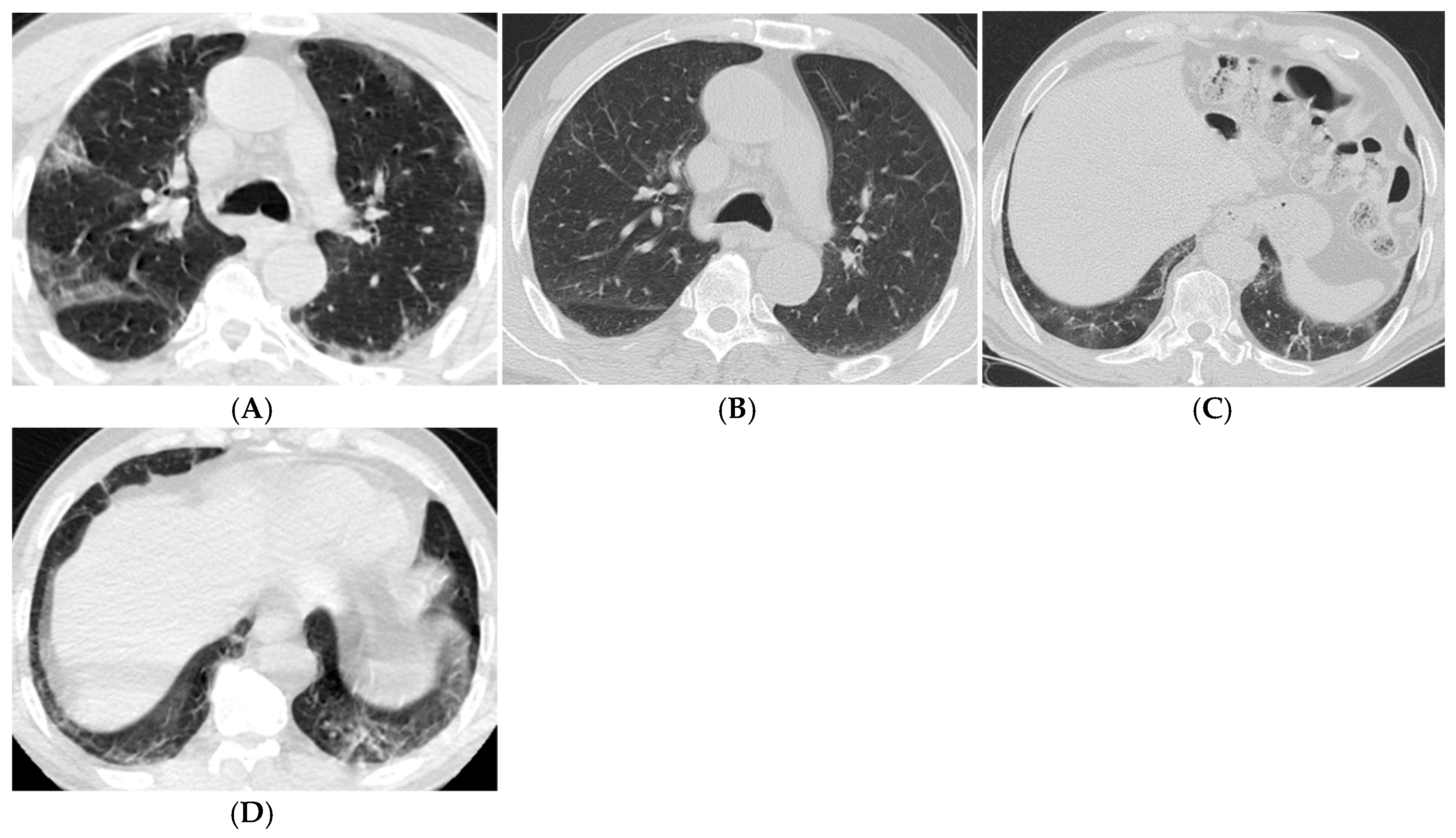 Tomography 11 00049 g002