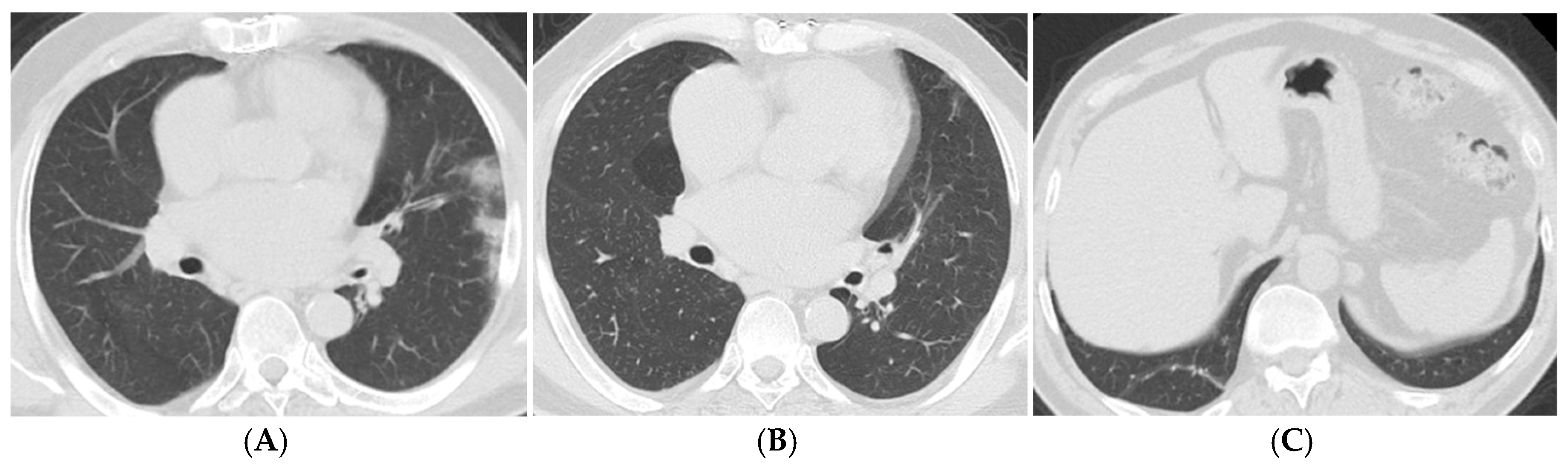 Tomography 11 00049 g003