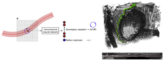 Medical Image Segmentation: A Comprehensive Review of Deep Learning ...