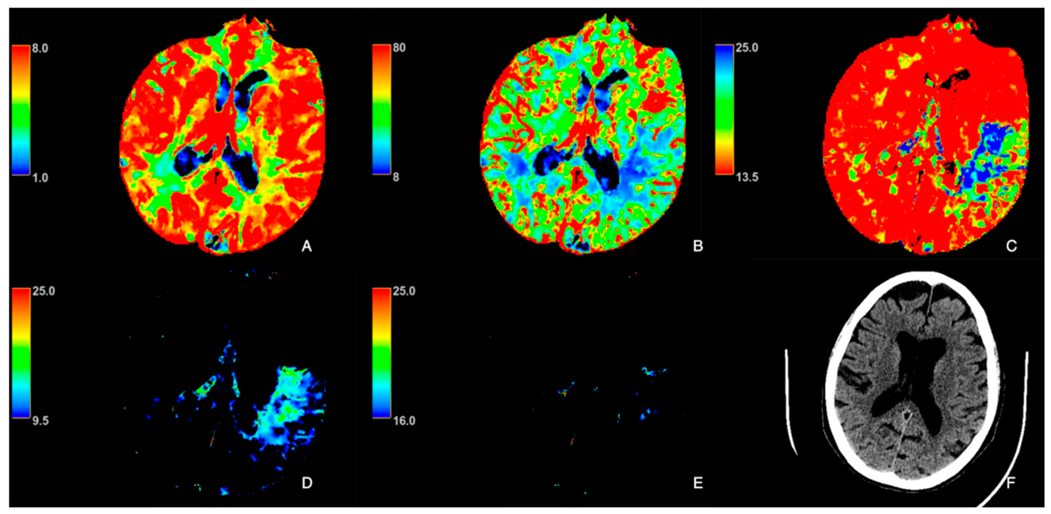 Tomography 11 00054 g002