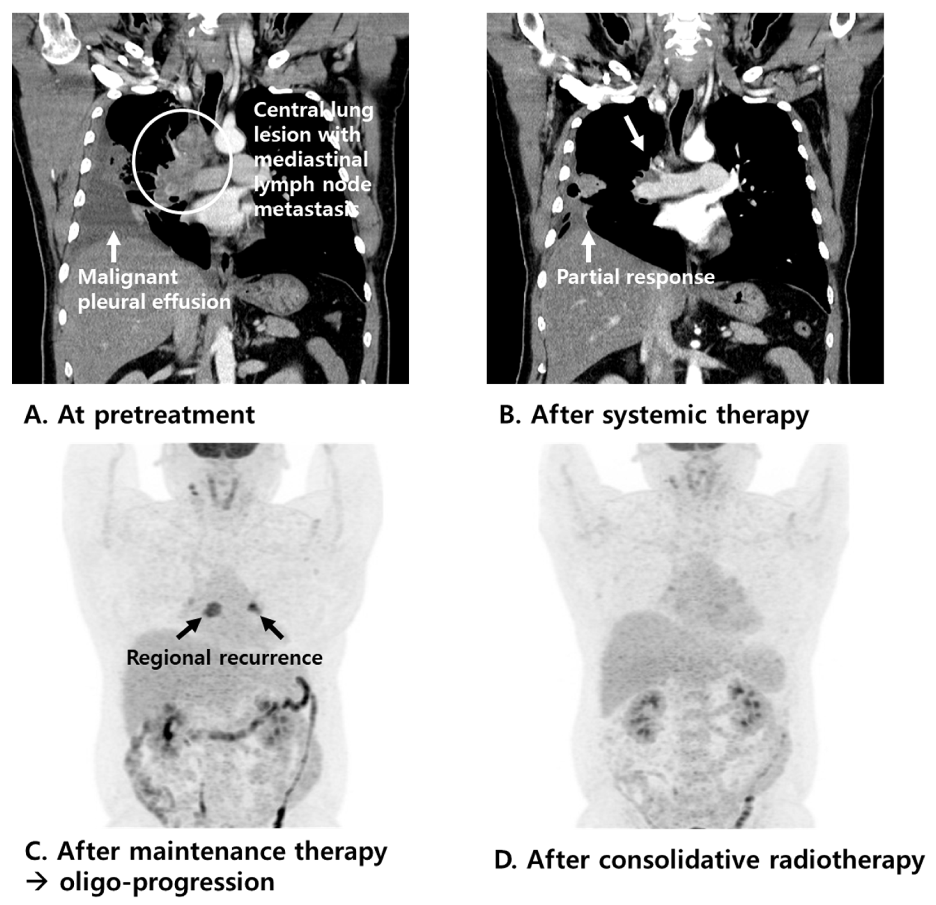 Tomography 11 00055 g003