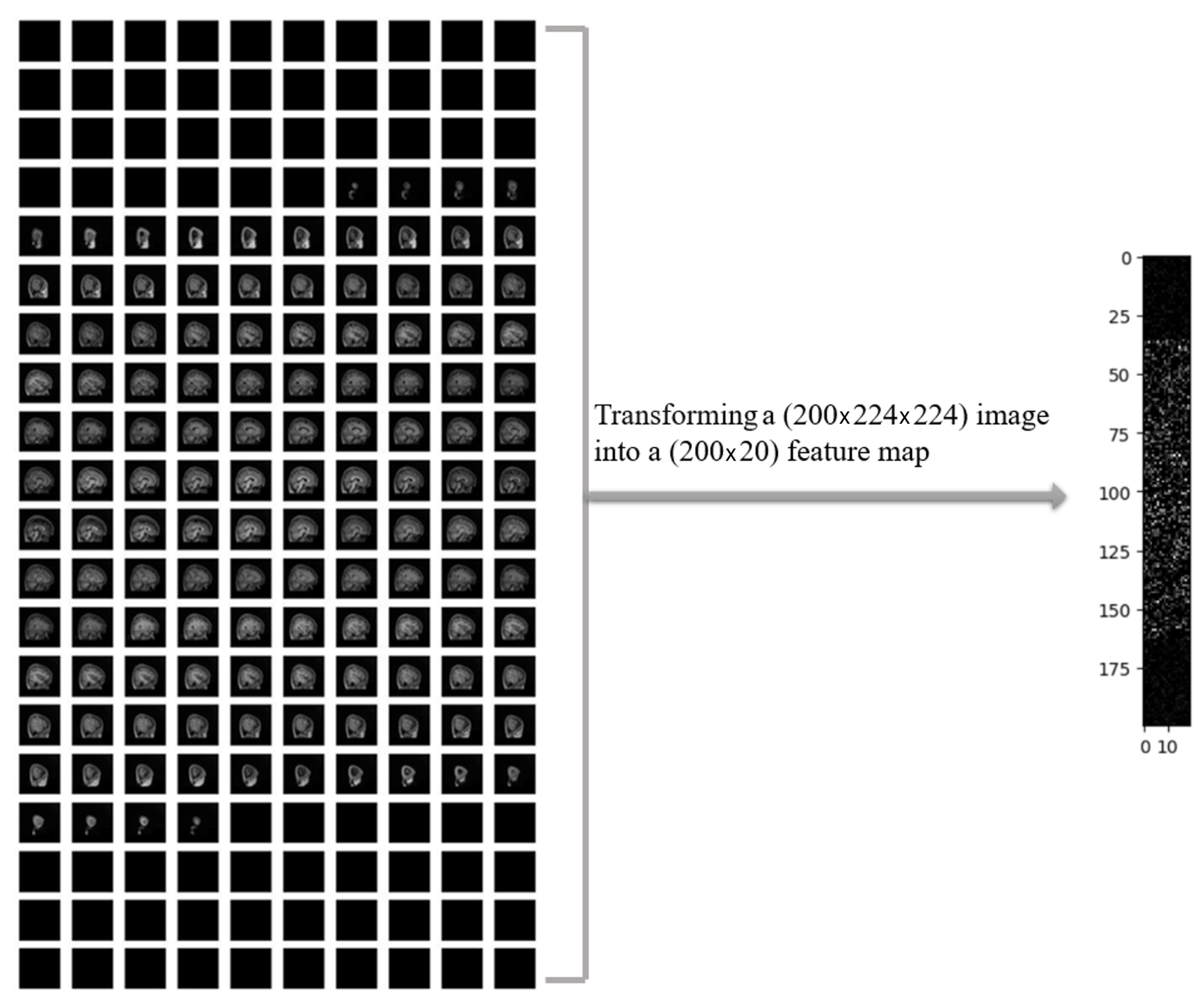 Tomography 11 00056 g004