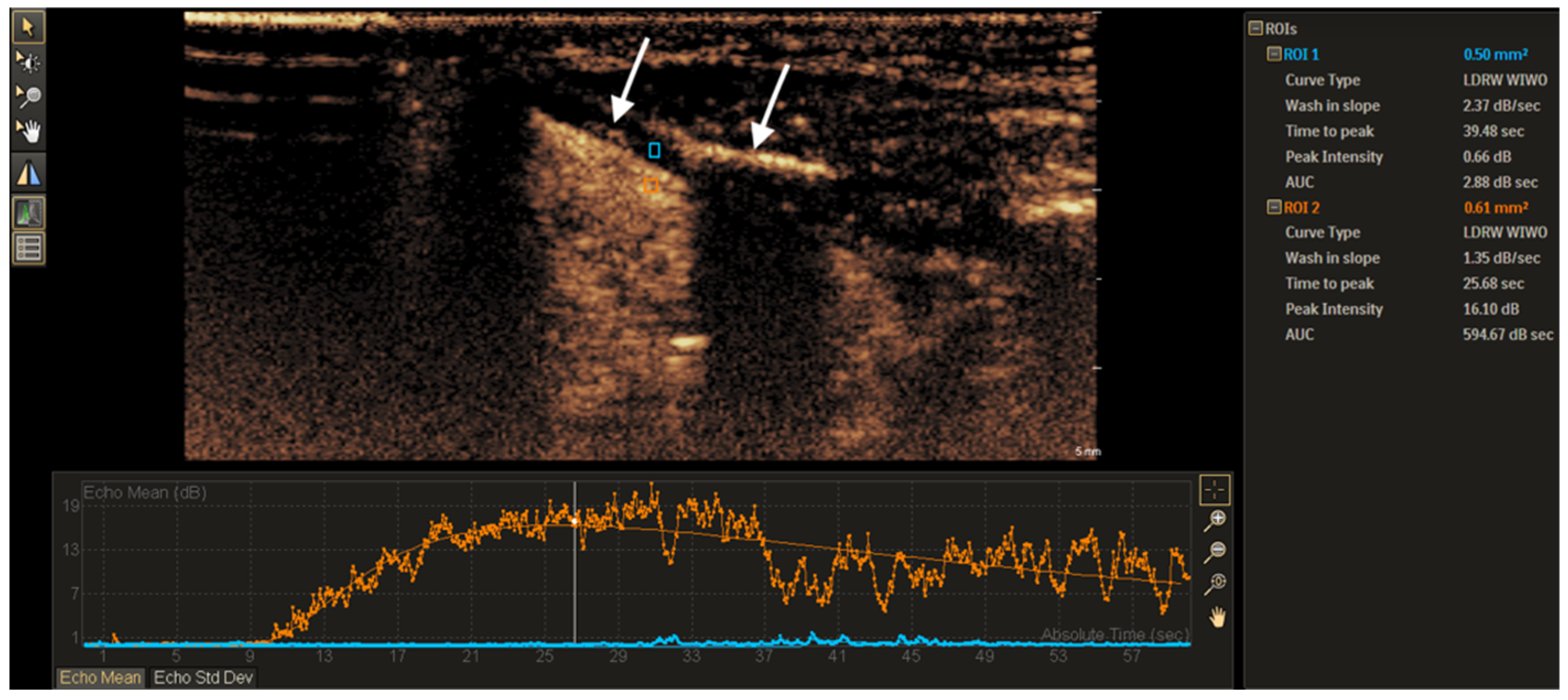 Tomography 11 00057 g001