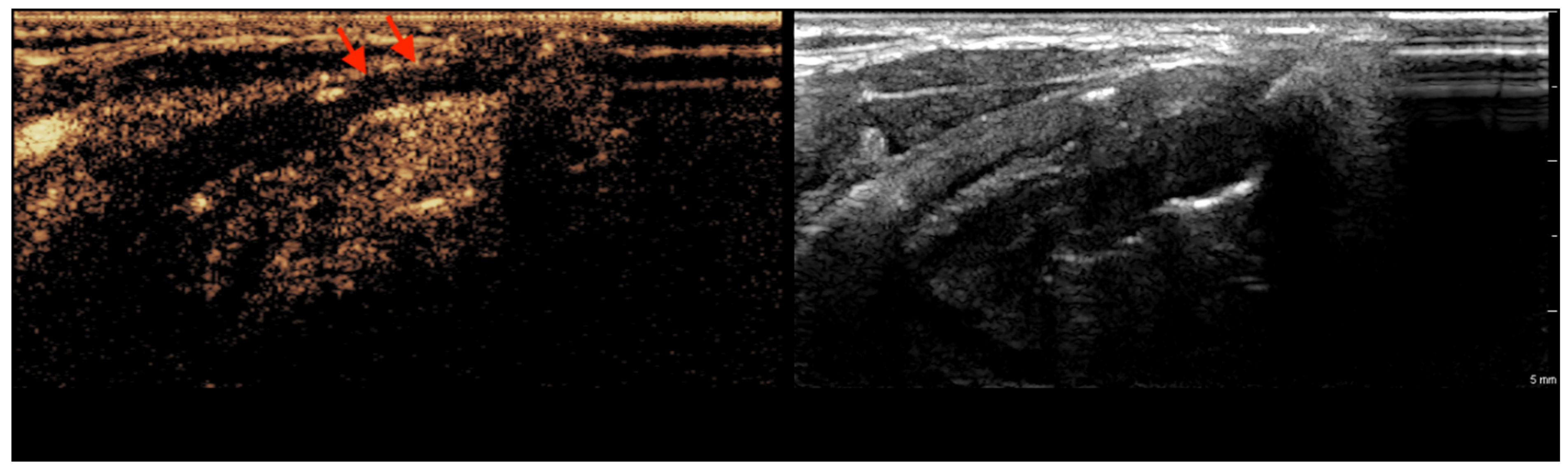 Tomography 11 00057 g002